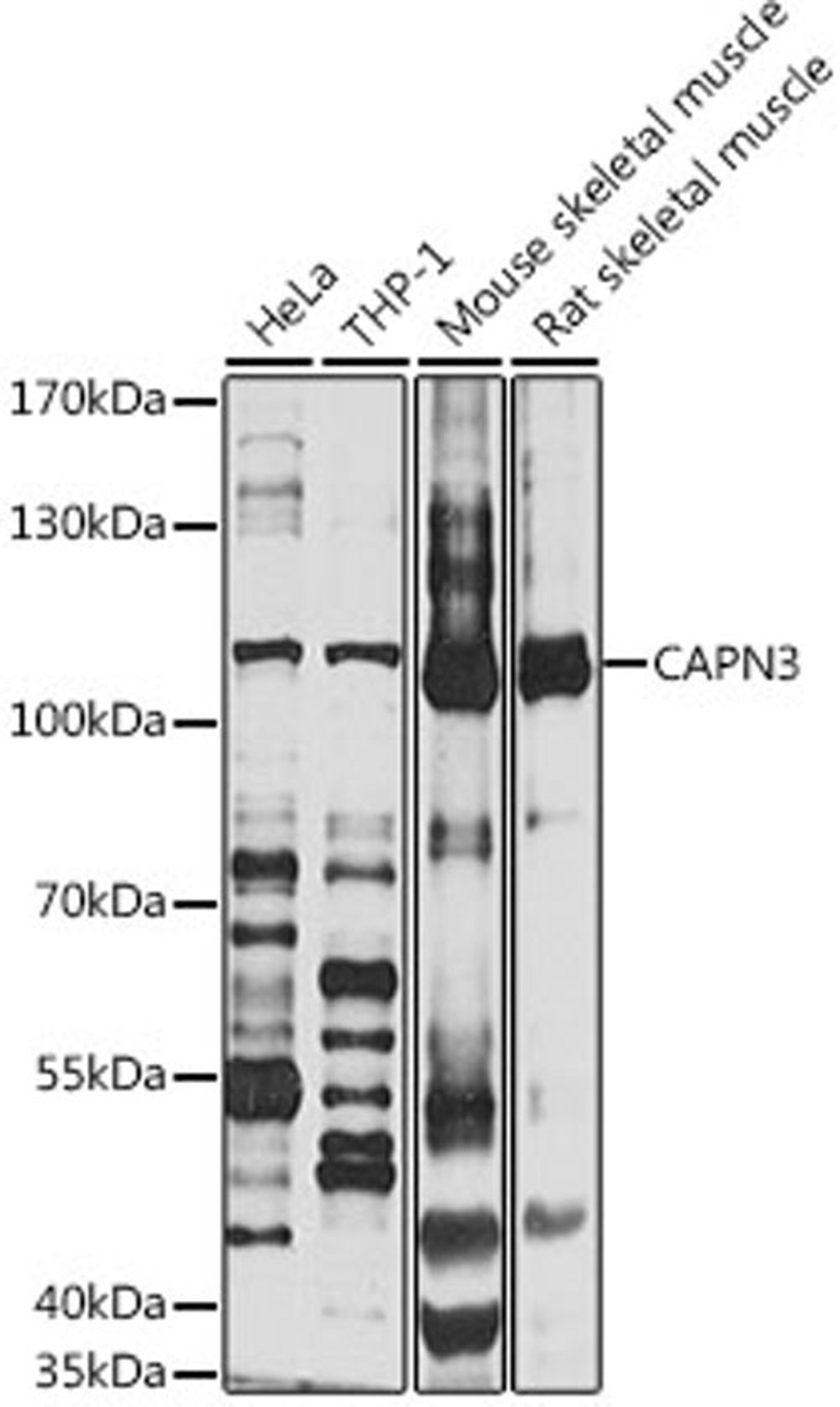 Western blot - CAPN3 antibody (A1893)