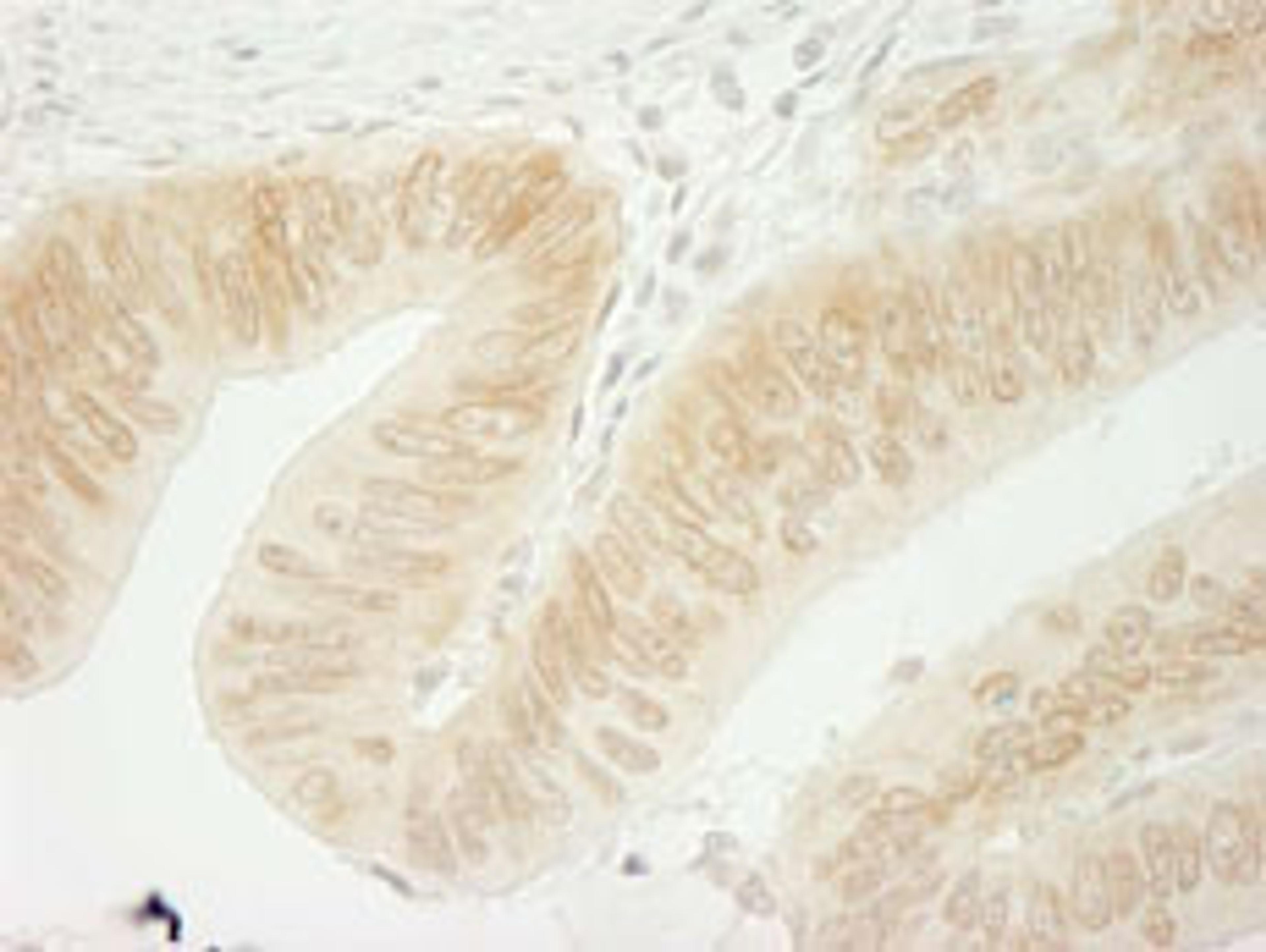 Detection of human CTNND1 by immunohistochemistry.