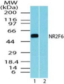 Western Blot: NR2F6 Antibody [NBP2-24510] - Analysis of NR2F6 in mouse embryo brain lysate in the 1) absence and 2) presence of immunizing peptide using NBP2-24510 at 5 ug/ml. Goat anti-rabbit Ig HRP secondary antibody and PicoTect ECL substrate solution were used for this test.