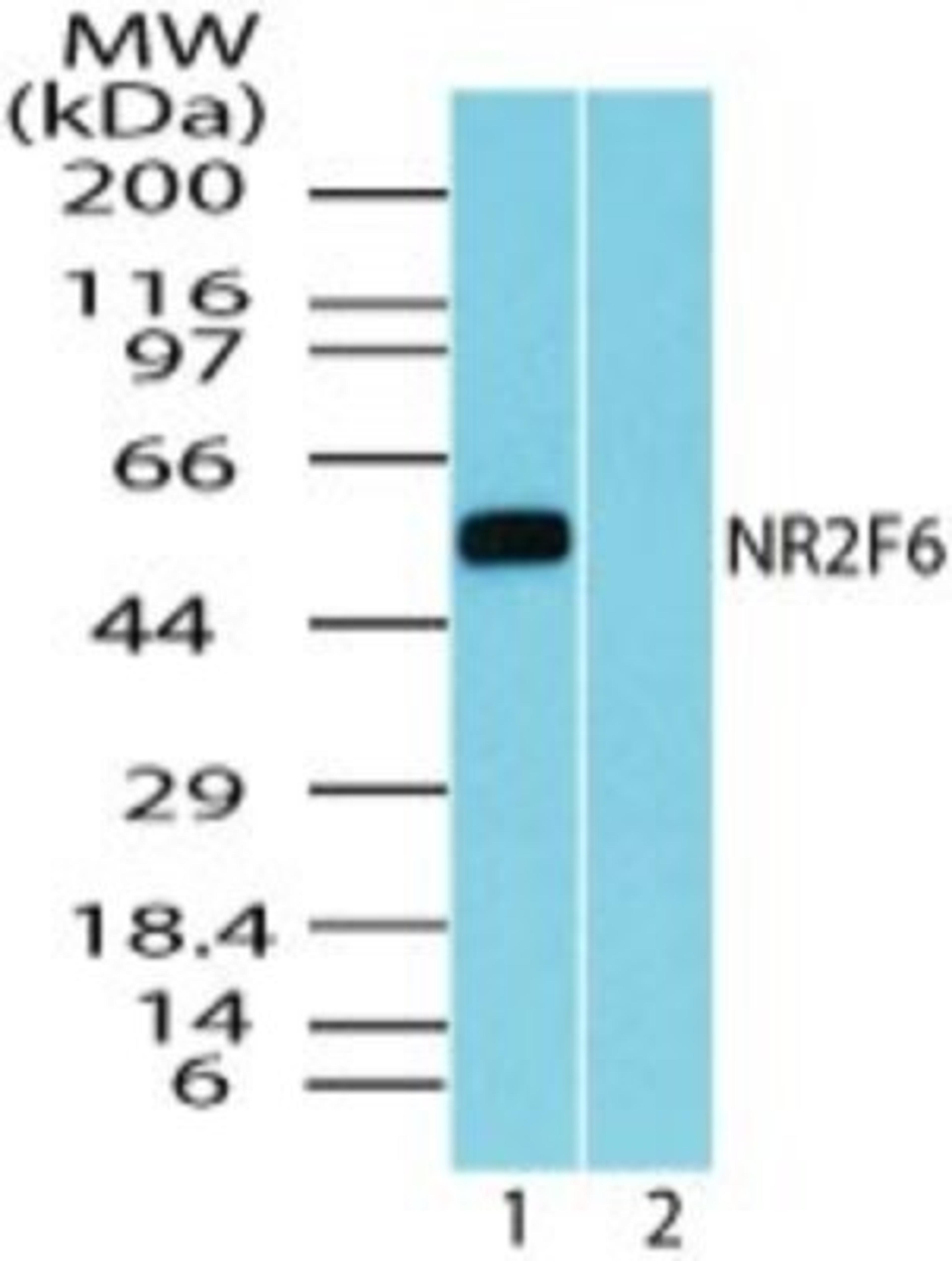 Western Blot: NR2F6 Antibody [NBP2-24510] - Analysis of NR2F6 in mouse embryo brain lysate in the 1) absence and 2) presence of immunizing peptide using NBP2-24510 at 5 ug/ml. Goat anti-rabbit Ig HRP secondary antibody and PicoTect ECL substrate solution were used for this test.