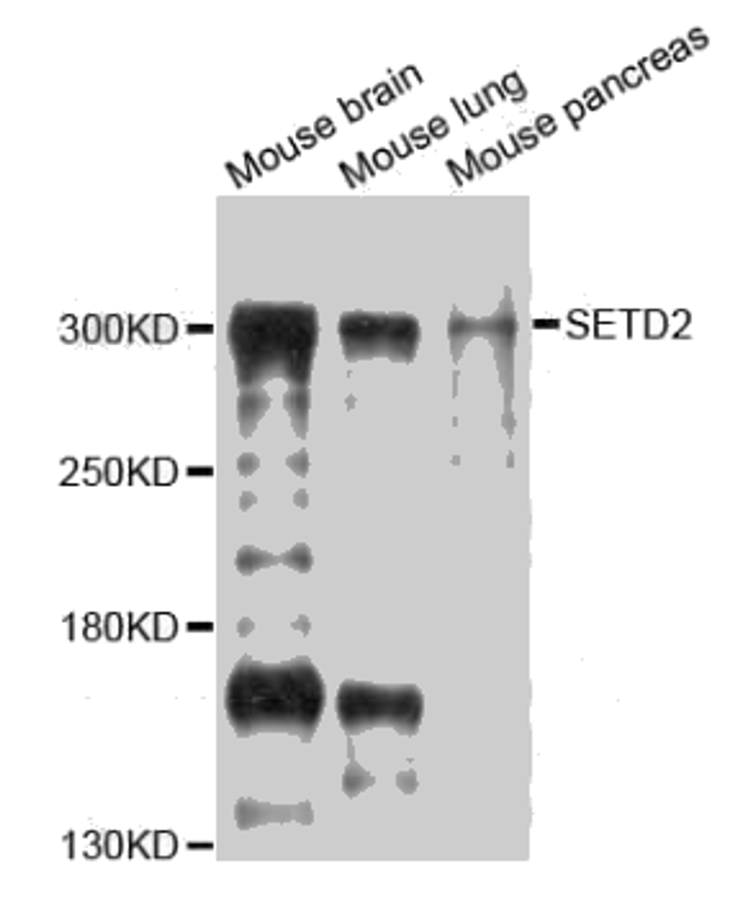 Western blot analysis of extracts of various cell lines, using SETD2 antibody