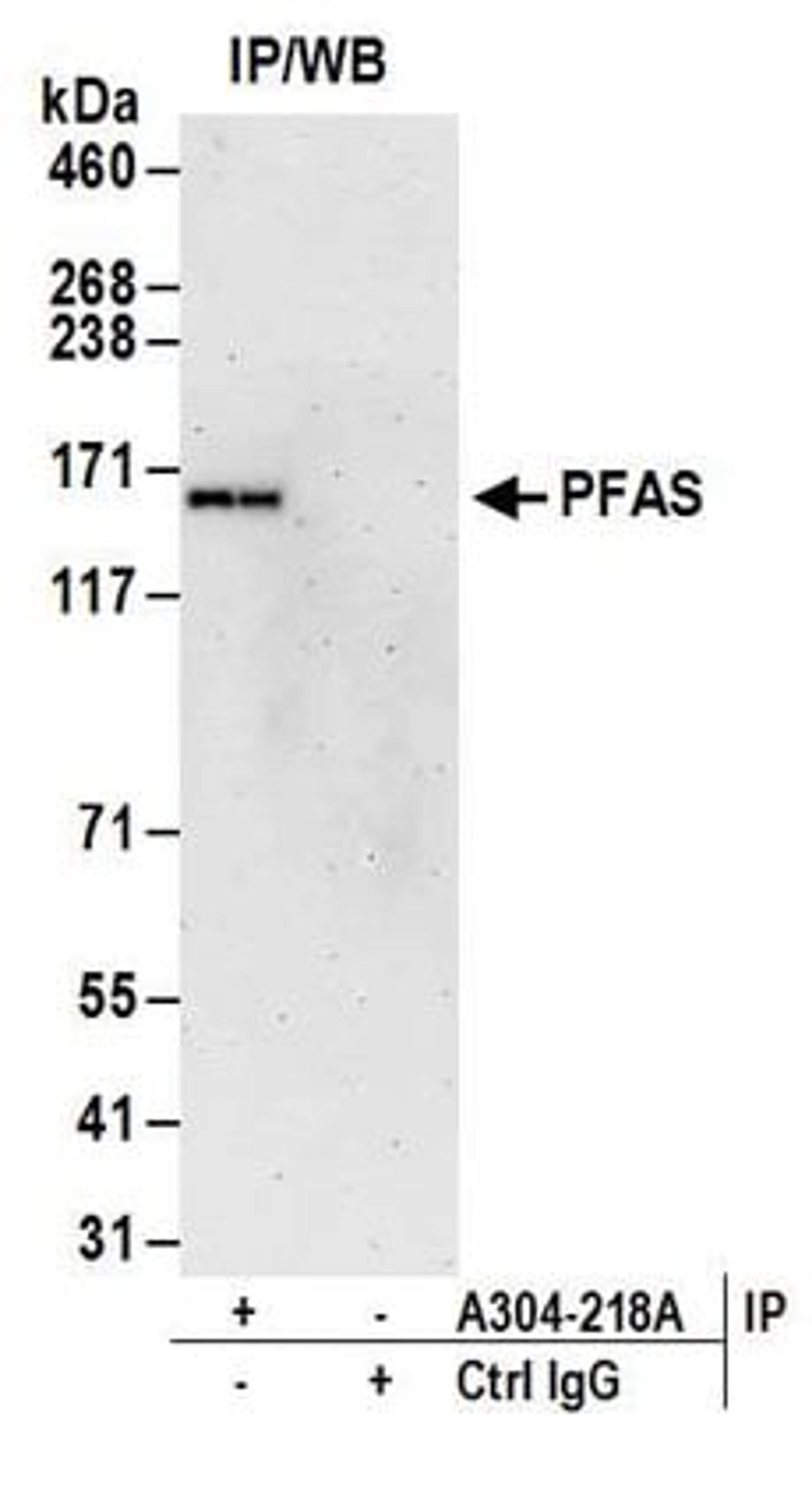 Detection of human PFAS by western blot of immunoprecipitates.