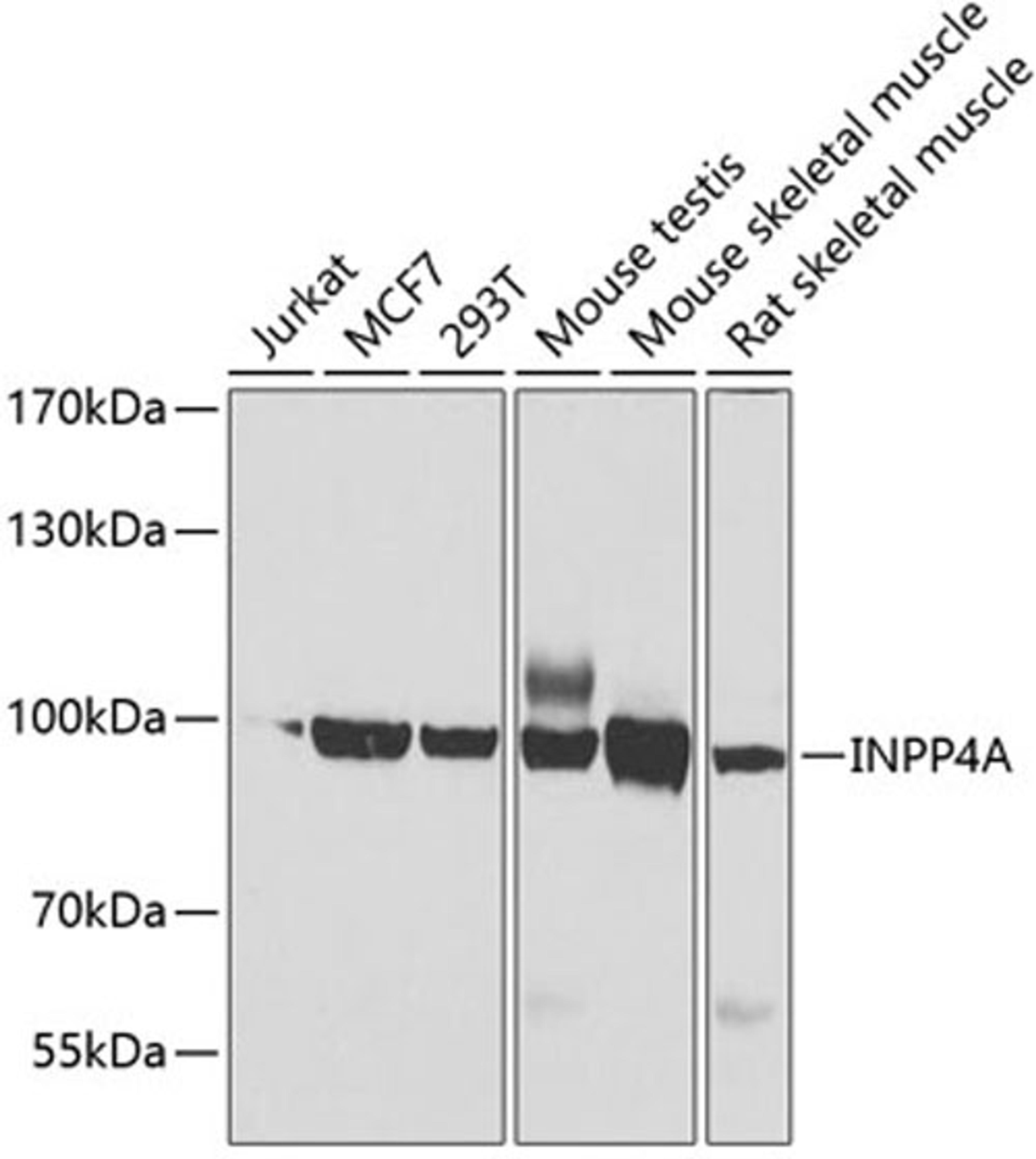 Western blot - INPP4A antibody (A7691)