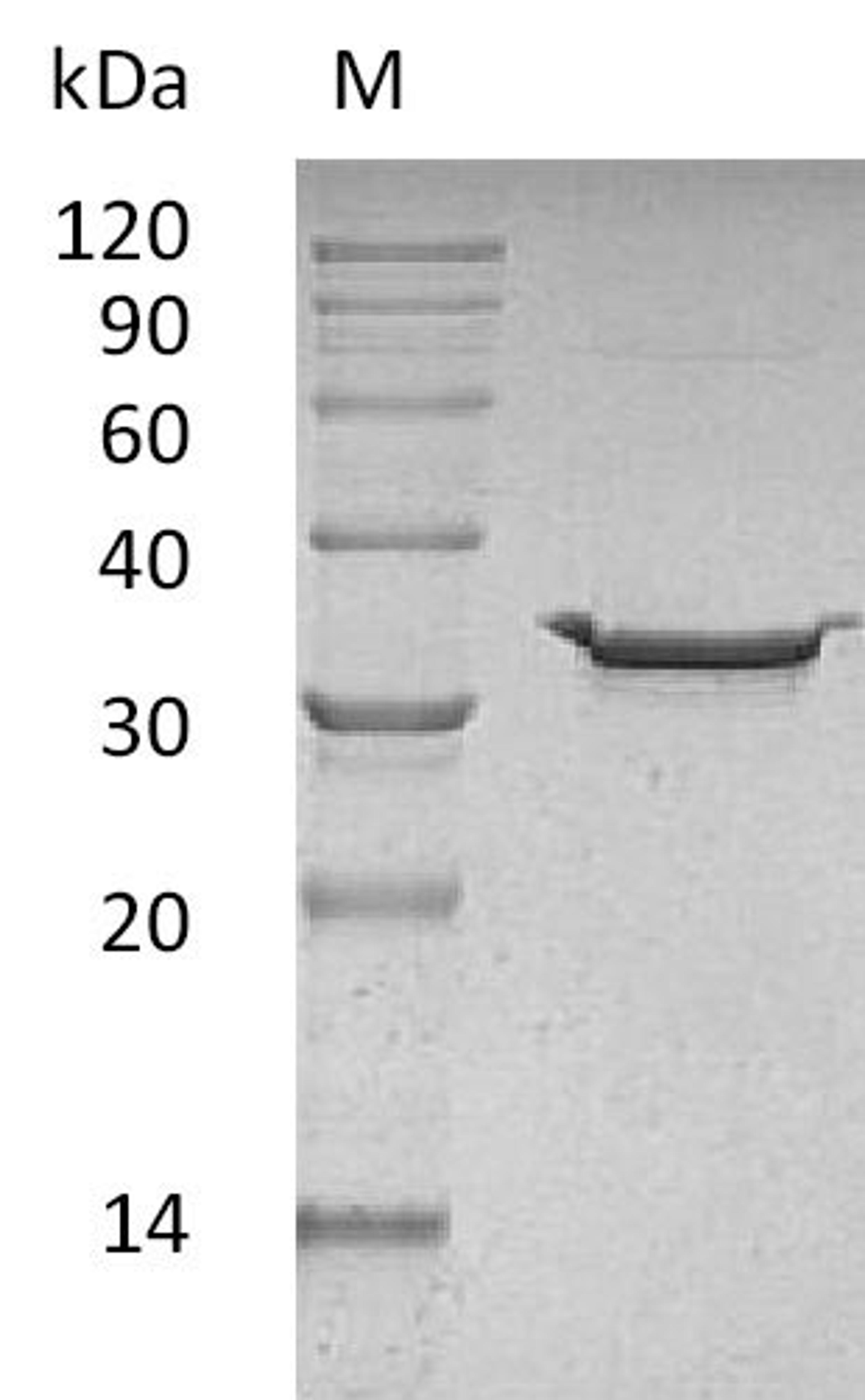 (Tris-Glycine gel) Discontinuous SDS-PAGE (reduced) with 5% enrichment gel and 15% separation gel.