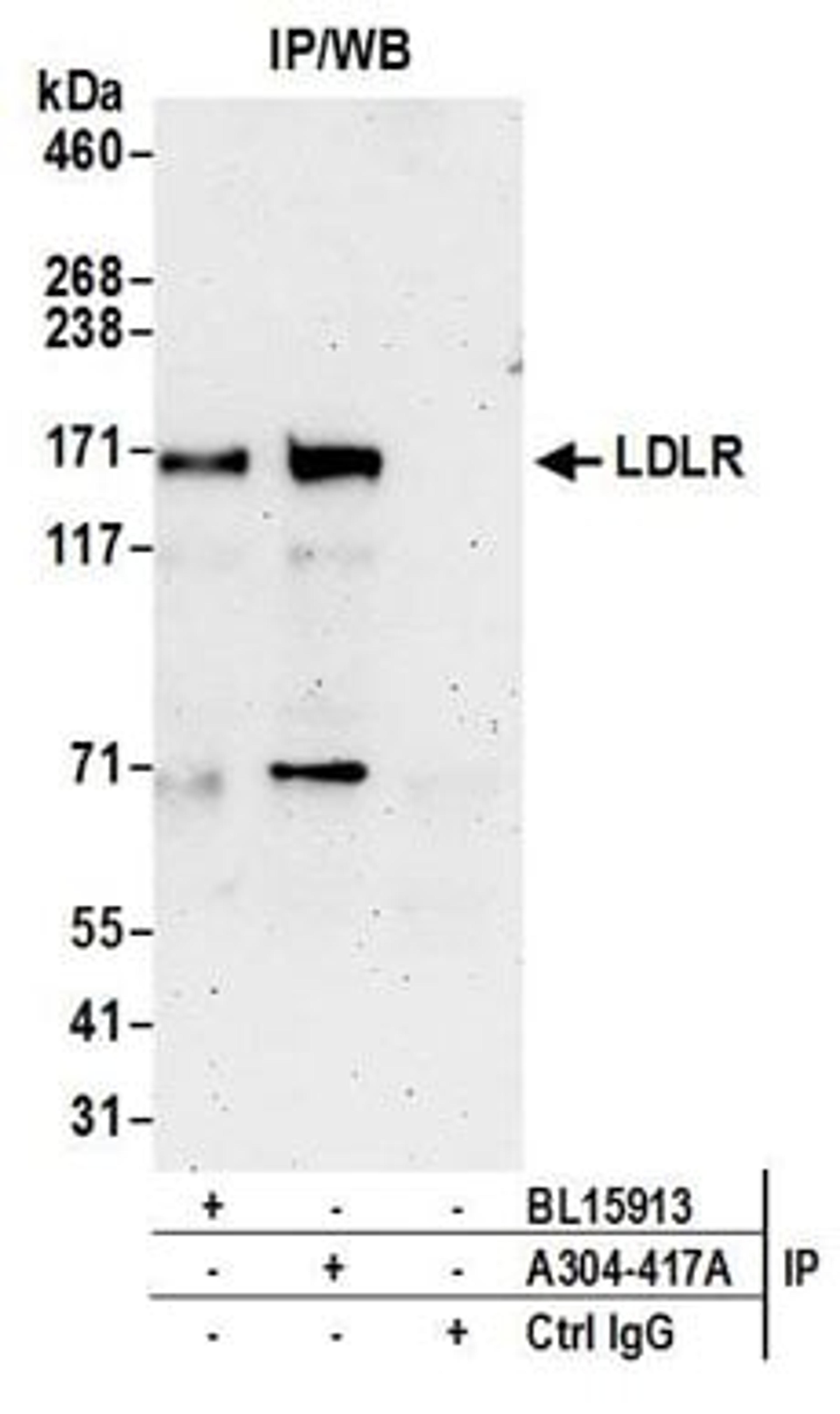 Detection of human LDLR by western blot of immunoprecipitates.