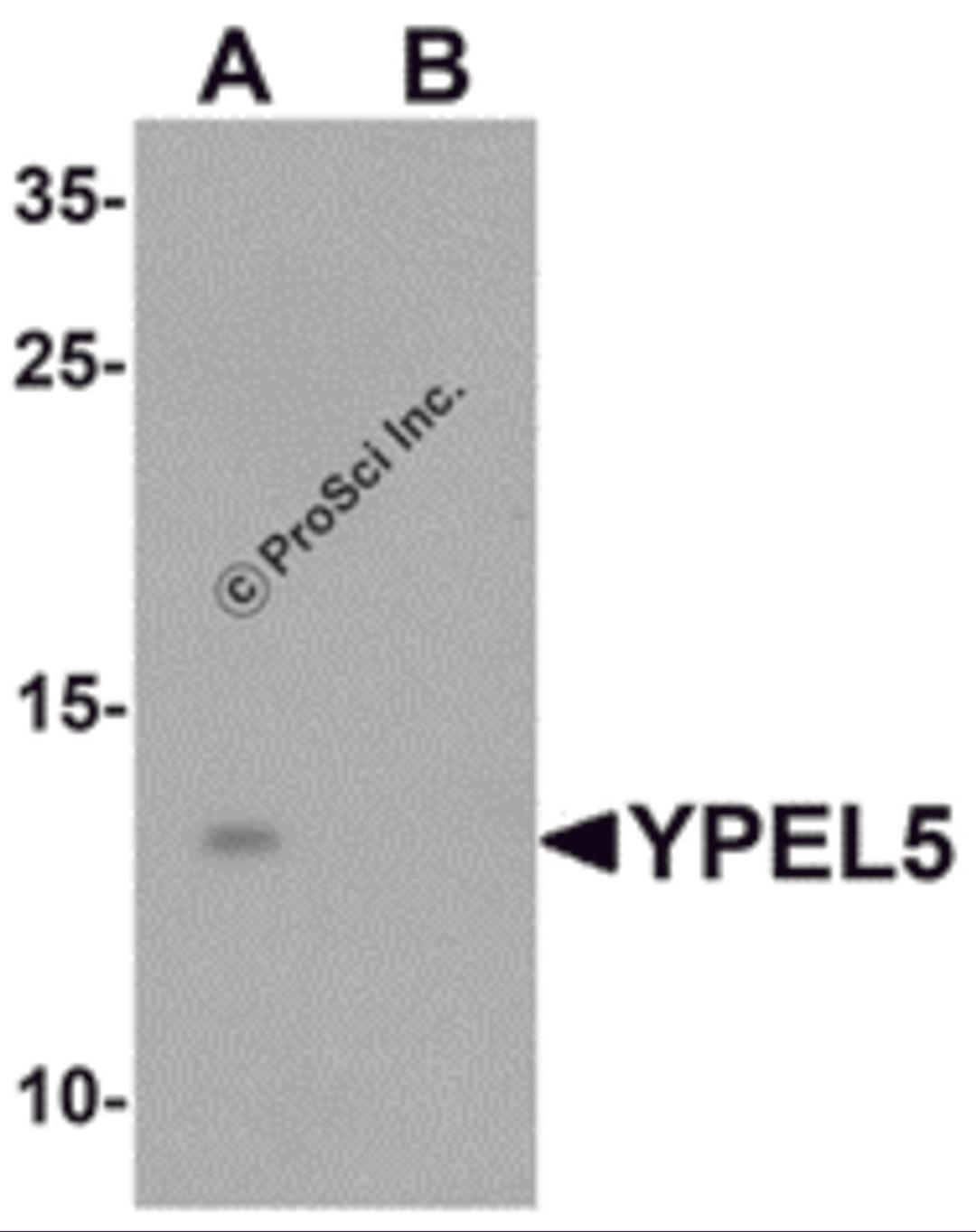 Western blot analysis of YPEL5 in A-20 cell lysate with YPEL5 antibody at 1 μg/mL in (A) the absence and (B) the presence of blocking peptide.