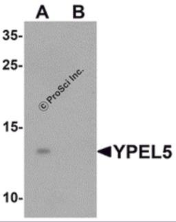 Western blot analysis of YPEL5 in A-20 cell lysate with YPEL5 antibody at 1 μg/mL in (A) the absence and (B) the presence of blocking peptide.