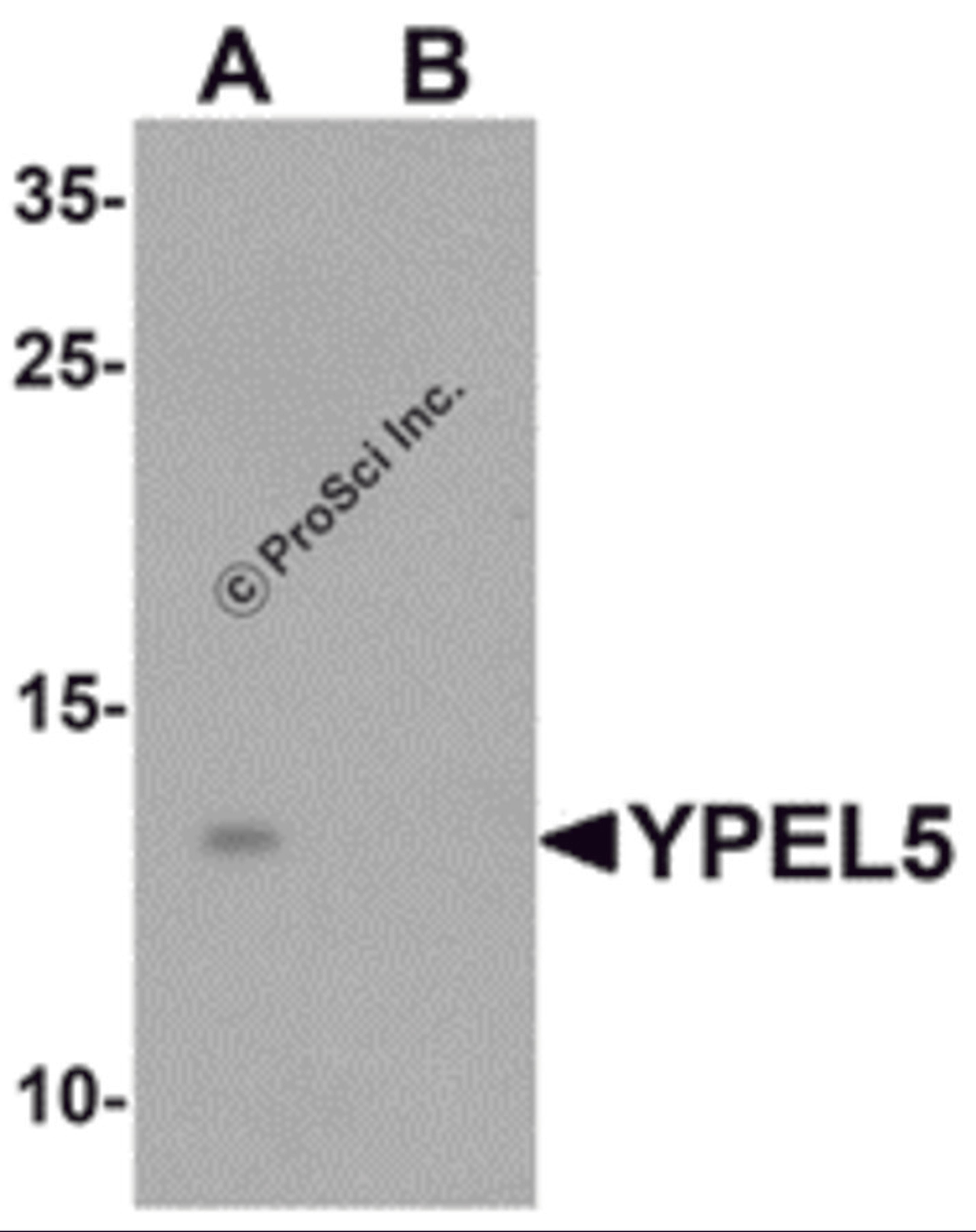 Western blot analysis of YPEL5 in A-20 cell lysate with YPEL5 antibody at 1 μg/mL in (A) the absence and (B) the presence of blocking peptide.