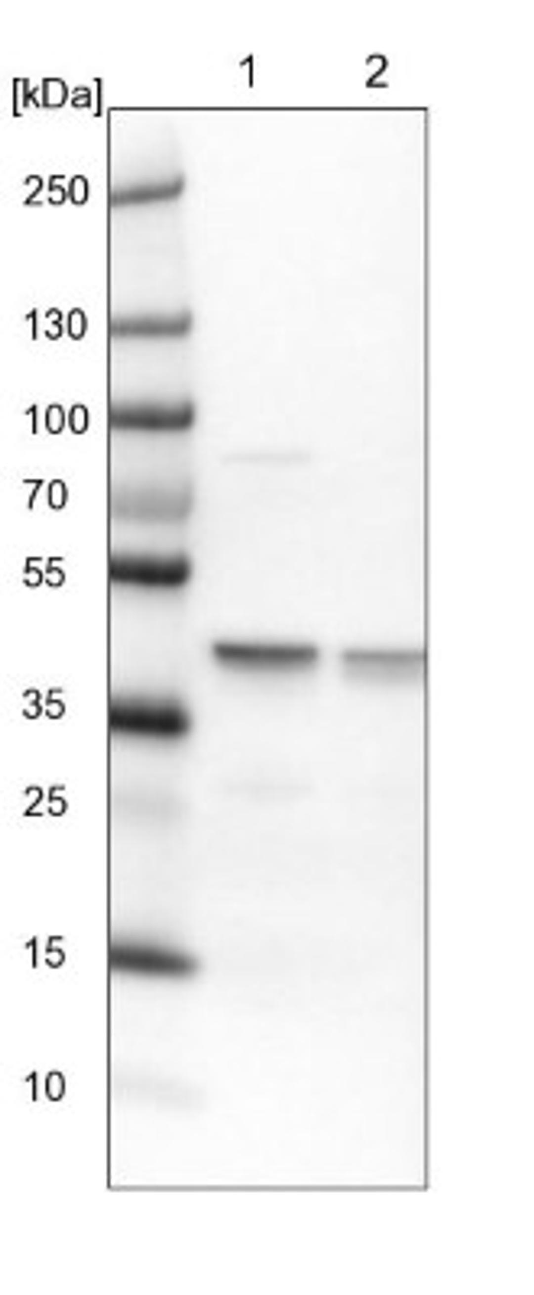 Western Blot: ECH1 Antibody [NBP1-83215] - Lane 1: NIH-3T3 cell lysate (Mouse embryonic fibroblast cells)<br/>Lane 2: NBT-II cell lysate (Rat Wistar bladder tumour cells)