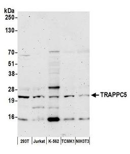 Detection of human and mouse TRAPPC5 by WB.