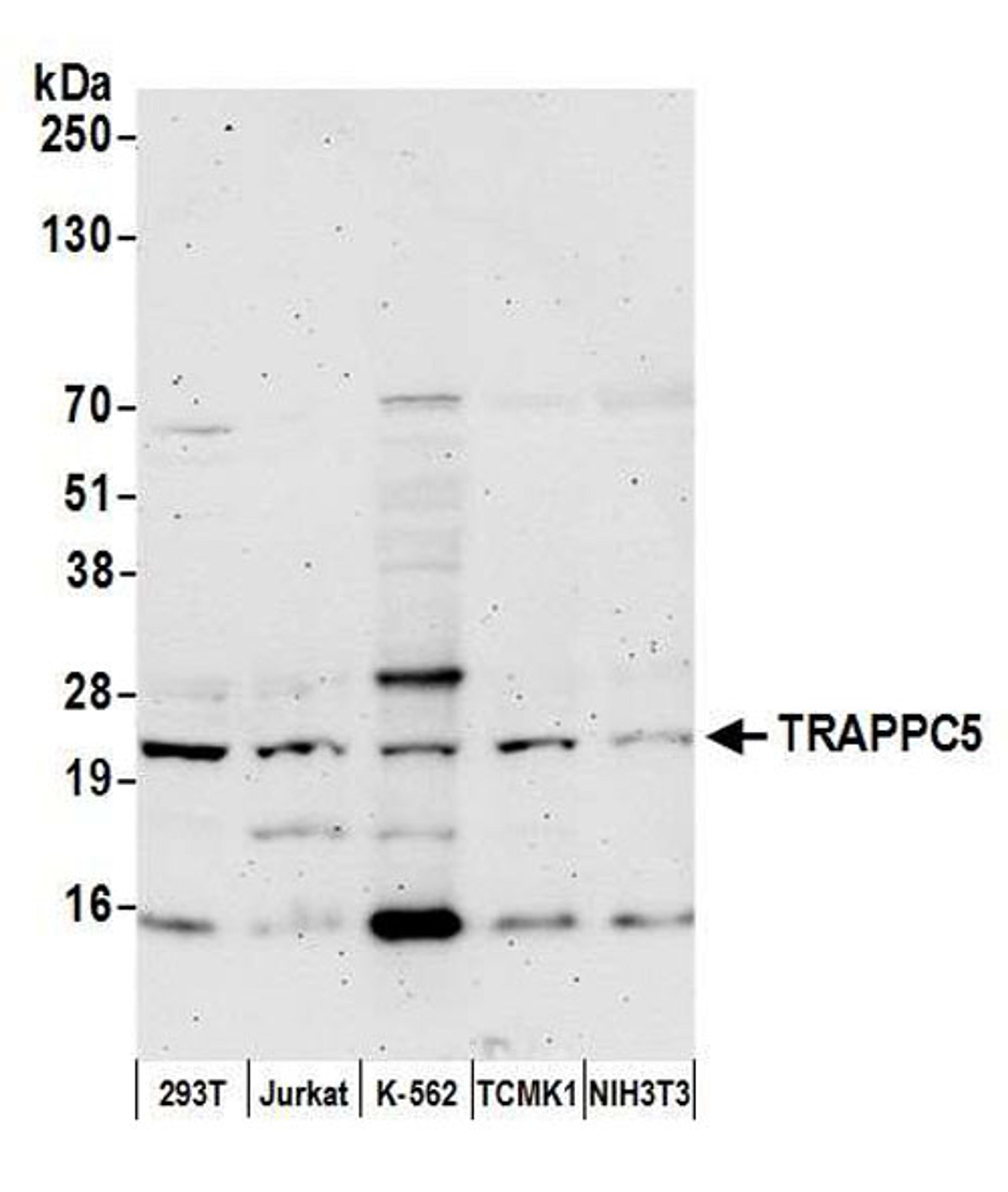 Detection of human and mouse TRAPPC5 by WB.