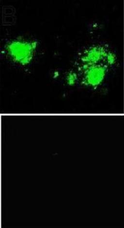 Immunocytochemistry/Immunofluorescence: beta Amyloid [Pyro Glu3] Antibody [NBP1-44048] - Laser scanning confocal microscopy was carried out using human tissue sections from frontal cortex. Figure A shows an example section that was immunostained for the presence of pyrE3Abeta (green). Figure B shows that the immunogen peptide completely blocked the NBP1-44048 antibody.