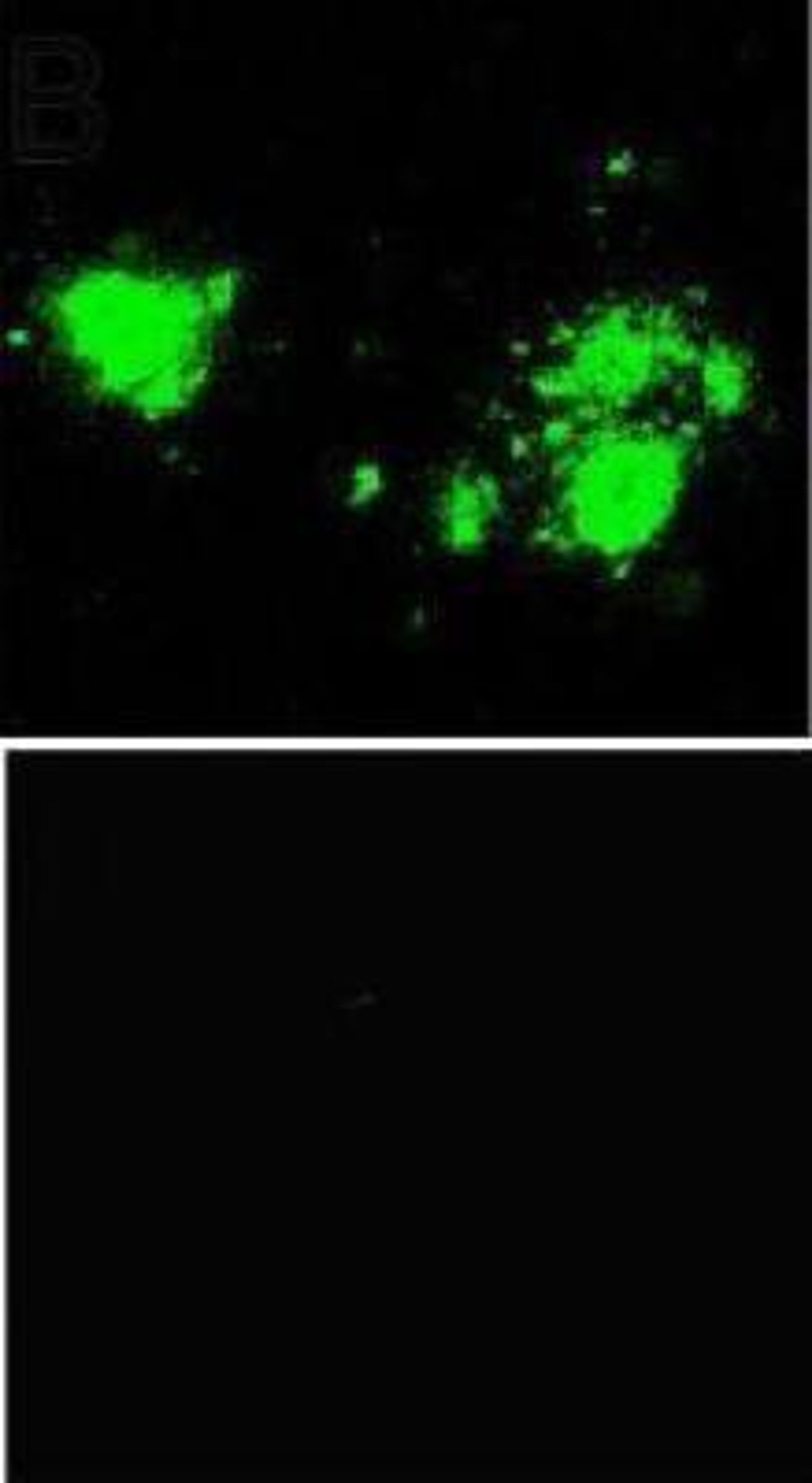 Immunocytochemistry/Immunofluorescence: beta Amyloid [Pyro Glu3] Antibody [NBP1-44048] - Laser scanning confocal microscopy was carried out using human tissue sections from frontal cortex. Figure A shows an example section that was immunostained for the presence of pyrE3Abeta (green). Figure B shows that the immunogen peptide completely blocked the NBP1-44048 antibody.