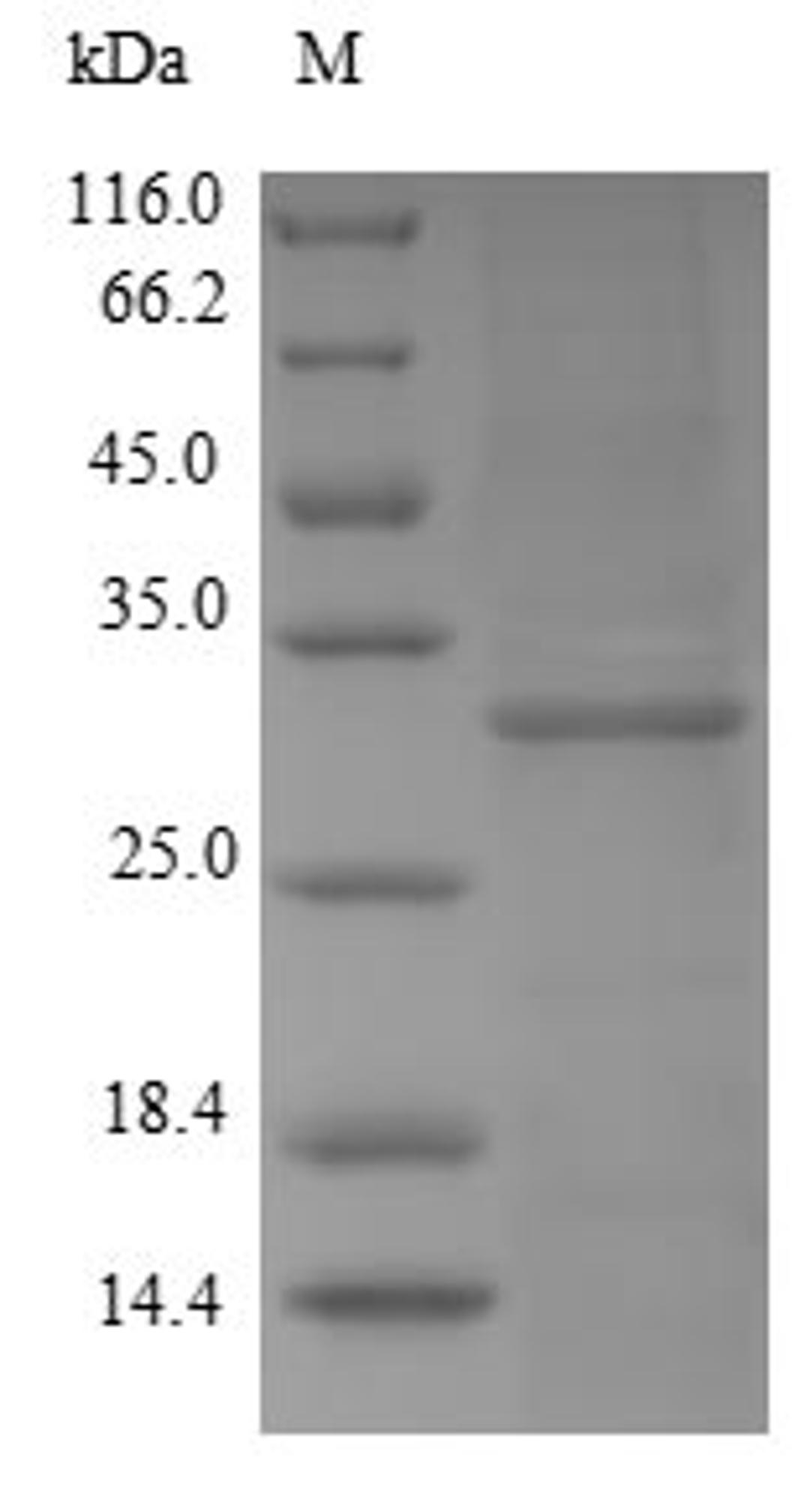 (Tris-Glycine gel) Discontinuous SDS-PAGE (reduced) with 5% enrichment gel and 15% separation gel.