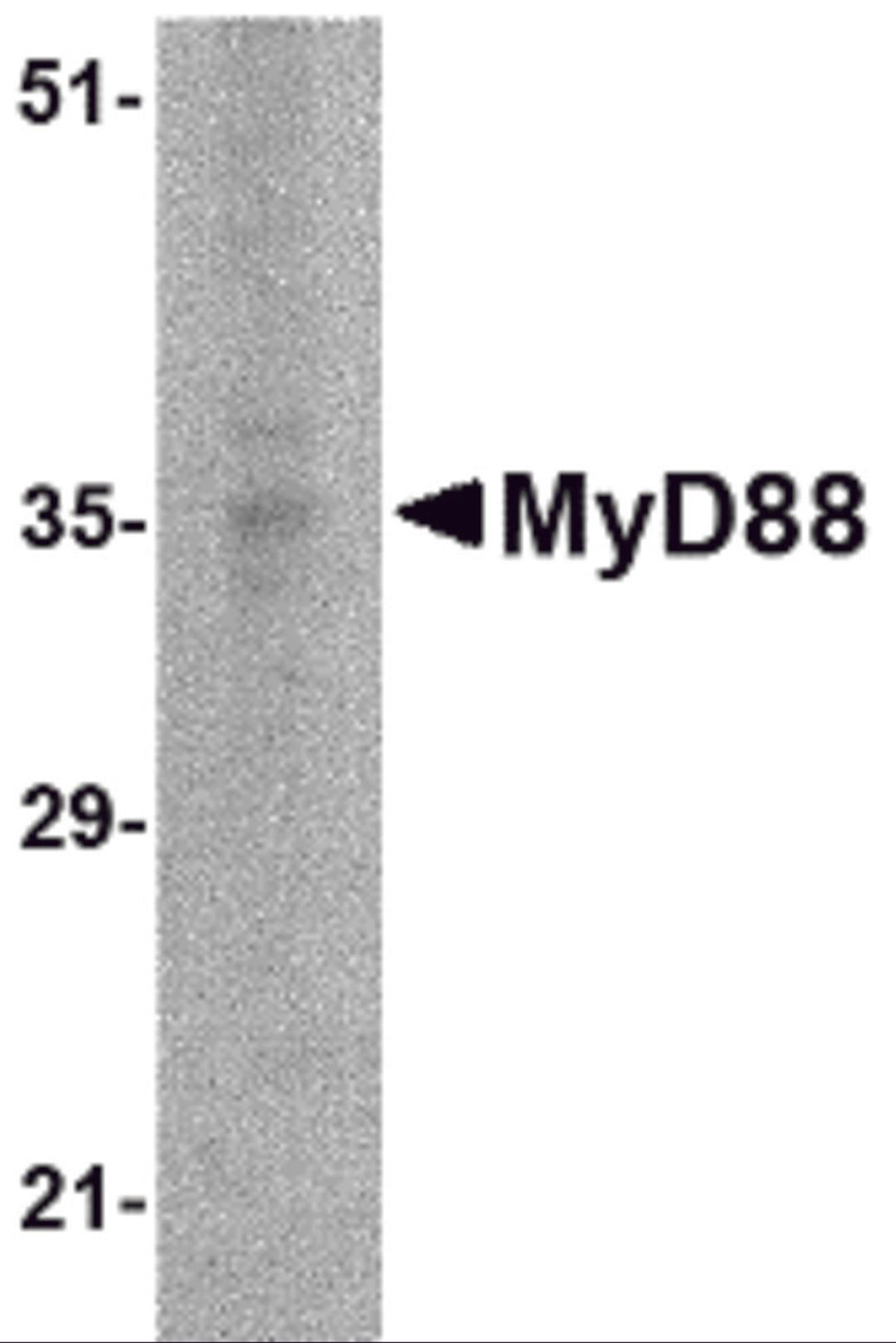 Western blot analysis of MyD88 in EL4 whole cell lysate with MyD88 antibody at 2 μg/mL.