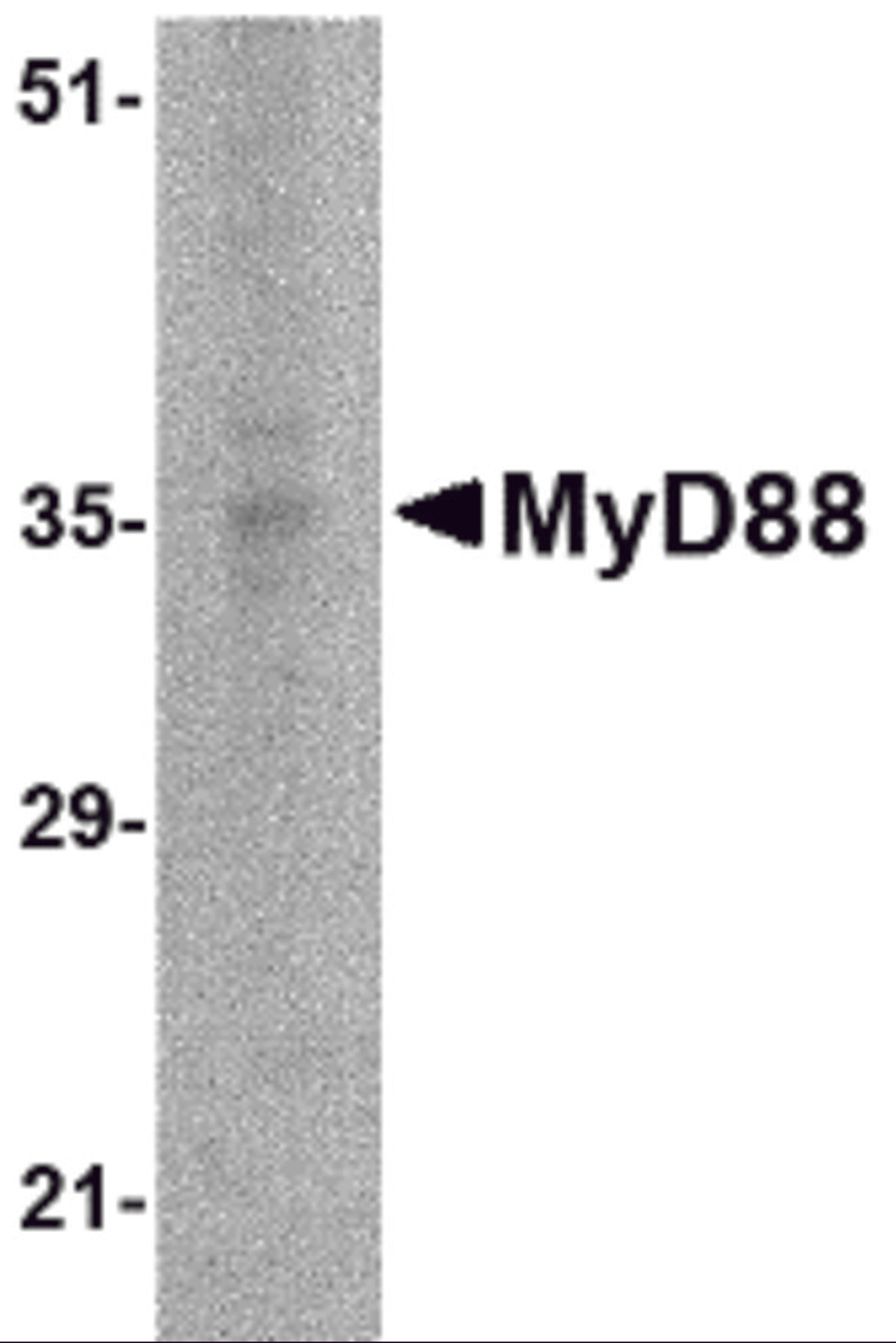 Western blot analysis of MyD88 in EL4 whole cell lysate with MyD88 antibody at 2 μg/mL.