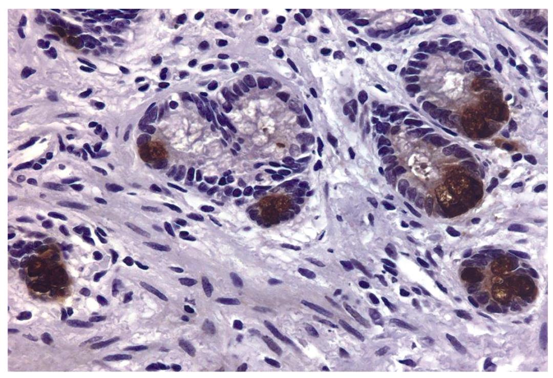 Human colon tissue was stained with Mouse Anti-Human MMP-9-UNLB (Cat. No. 99-773) followed by Goat Anti-Mouse IgG2a, Human ads-BIOT and Streptavidin-HRP .