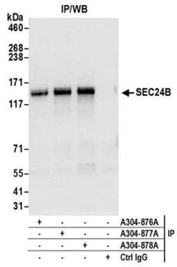 Detection of human SEC24B by western blot of immunoprecipitates.