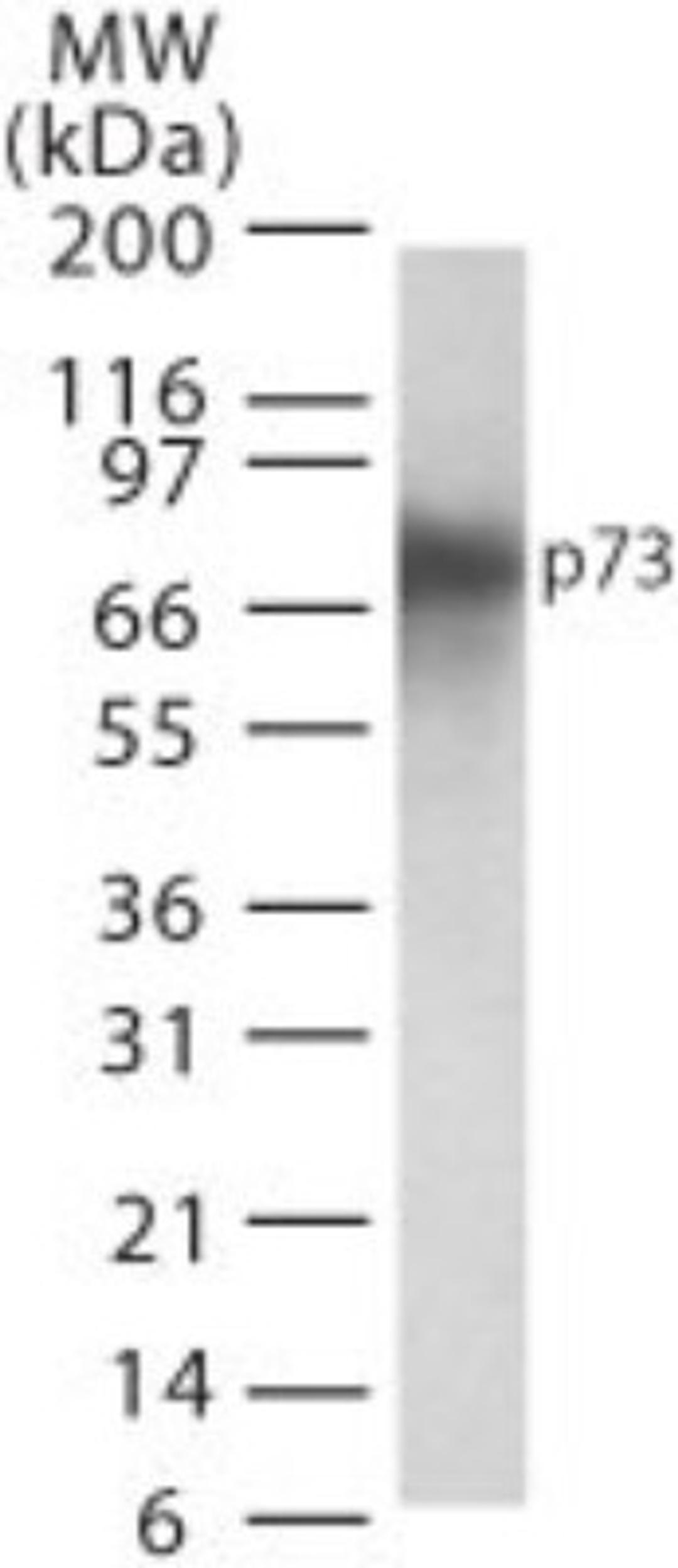 Western Blot: p73 Antibody (5B1288) [NB100-56674] - Analysis of p73 in transfected cell lysate using this antibody.