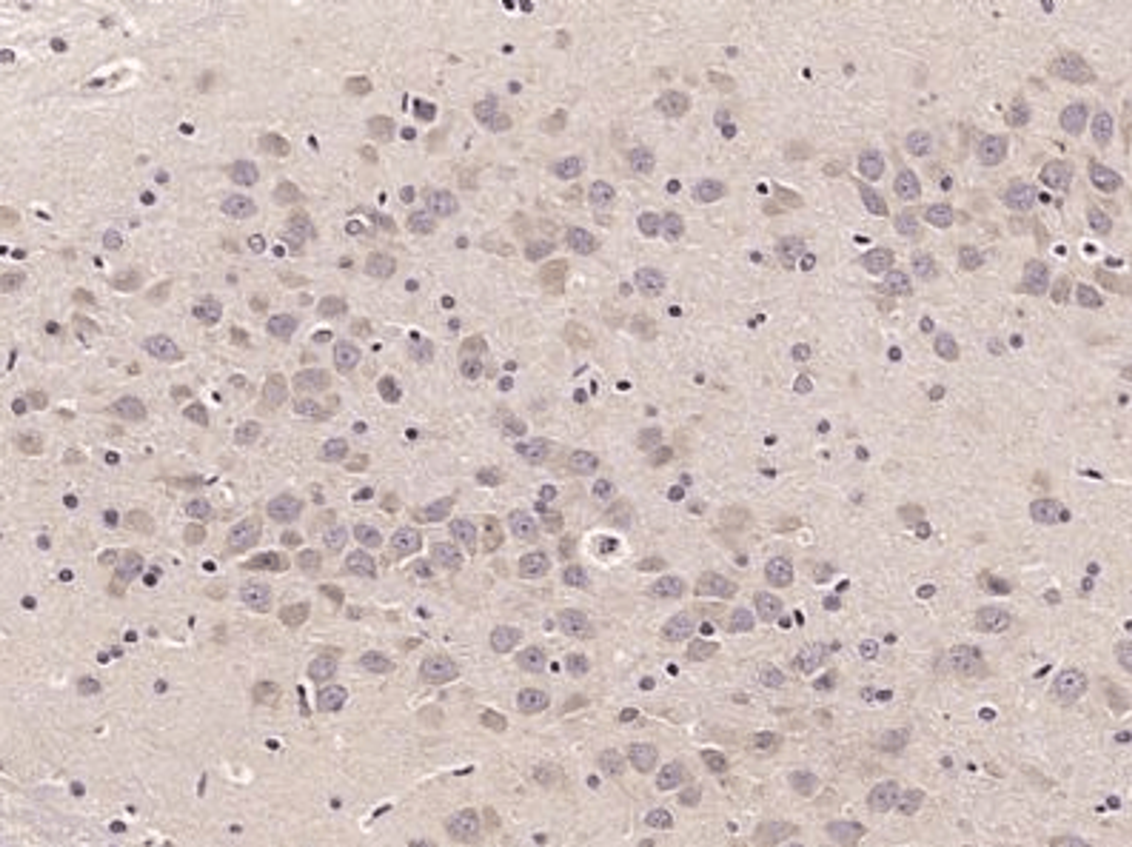 Immunohistochemical staining of rat brain using NEK1 antibody