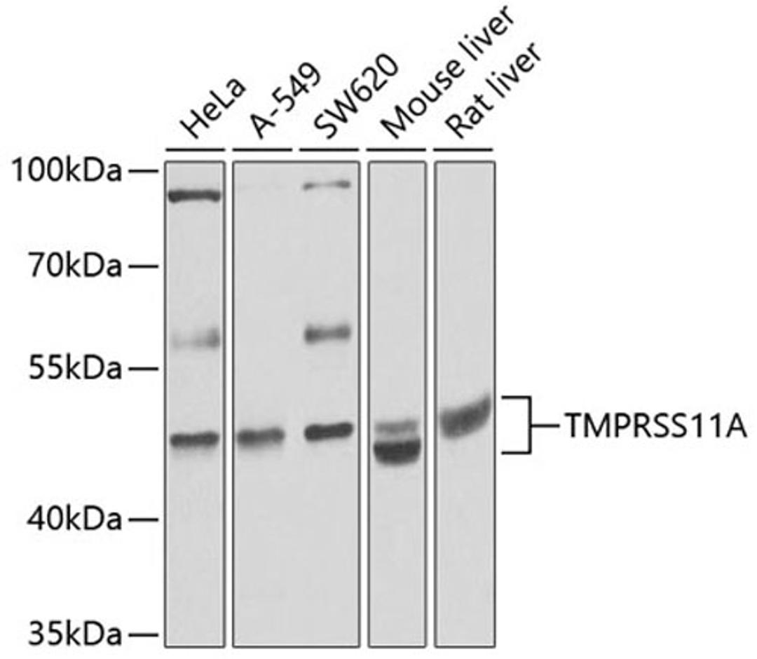 Western blot - TMPRSS11A antibody (A8605)