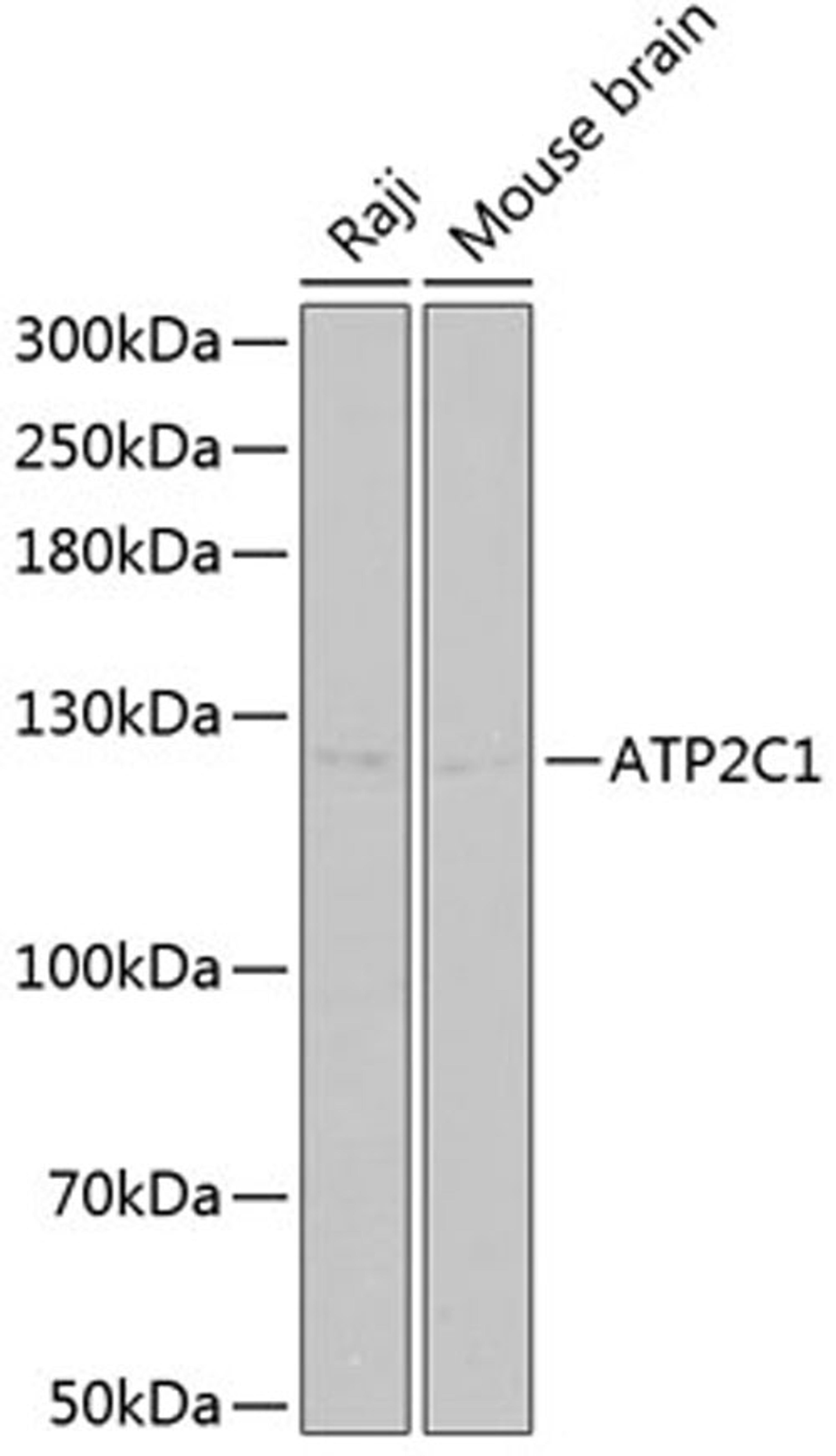 Western blot - ATP2C1 Antibody (A2515)