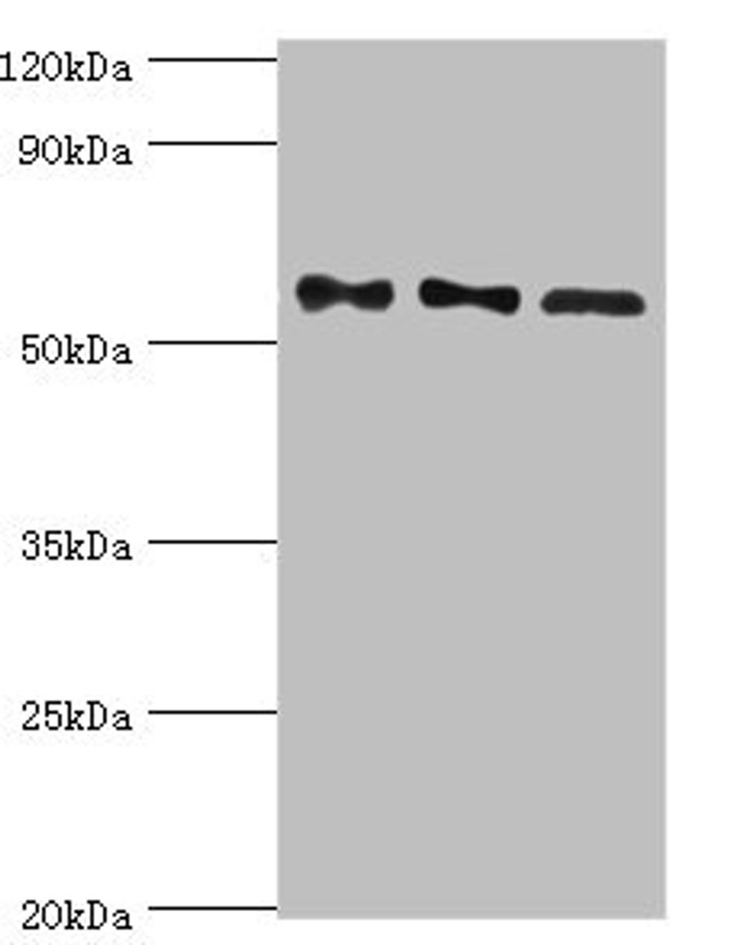 Western blot. All lanes: Serine/threonine-protein phosphatase 2B catalytic subunit gamma isoform antibody at 10ug/ml. Lane 1: Rat brain tissue. Lane 2: MCF-7 whole cell lysate. Lane 3: Rat skeletal muscle tissue. Secondary. Goat polyclonal to rabbit IgG at 1/10000 dilution. Predicted band size: 59, 58, 60 kDa. Observed band size: 59 kDa.