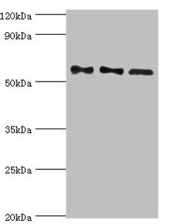 Western blot. All lanes: Serine/threonine-protein phosphatase 2B catalytic subunit gamma isoform antibody at 10ug/ml. Lane 1: Rat brain tissue. Lane 2: MCF-7 whole cell lysate. Lane 3: Rat skeletal muscle tissue. Secondary. Goat polyclonal to rabbit IgG at 1/10000 dilution. Predicted band size: 59, 58, 60 kDa. Observed band size: 59 kDa.