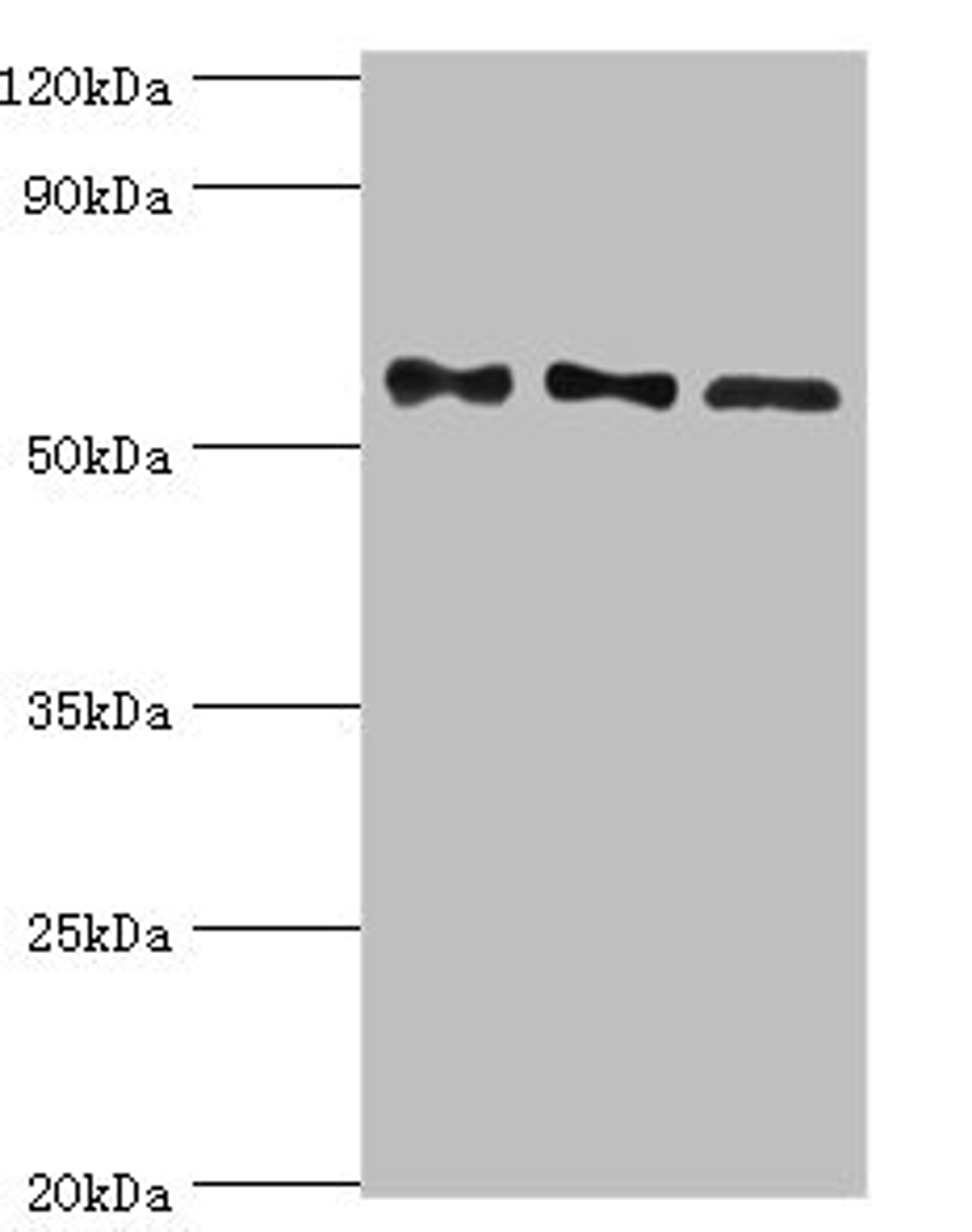 Western blot. All lanes: Serine/threonine-protein phosphatase 2B catalytic subunit gamma isoform antibody at 10ug/ml. Lane 1: Rat brain tissue. Lane 2: MCF-7 whole cell lysate. Lane 3: Rat skeletal muscle tissue. Secondary. Goat polyclonal to rabbit IgG at 1/10000 dilution. Predicted band size: 59, 58, 60 kDa. Observed band size: 59 kDa.