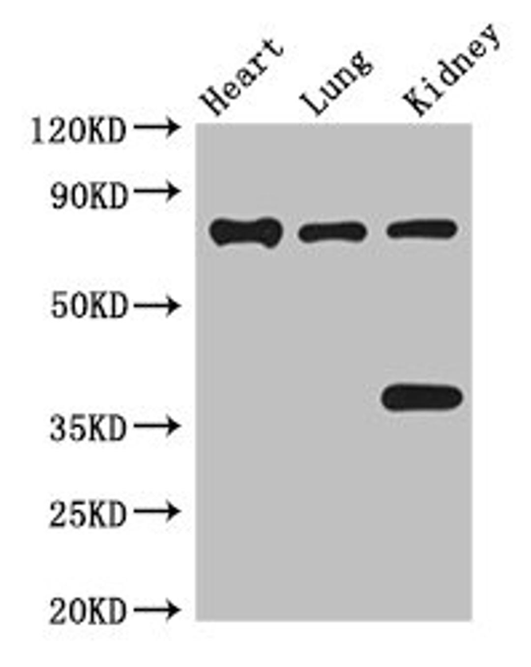 Western Blot. Positive WB detected in: Mouse heart tissue, Mouse lung tissue, Mouse kidney tissue. All lanes: BRSK1 antibody at 3.5ug/ml. Secondary. Goat polyclonal to rabbit IgG at 1/50000 dilution. Predicted band size: 86, 87, 39 kDa. Observed band size: 86, 39 kDa. 