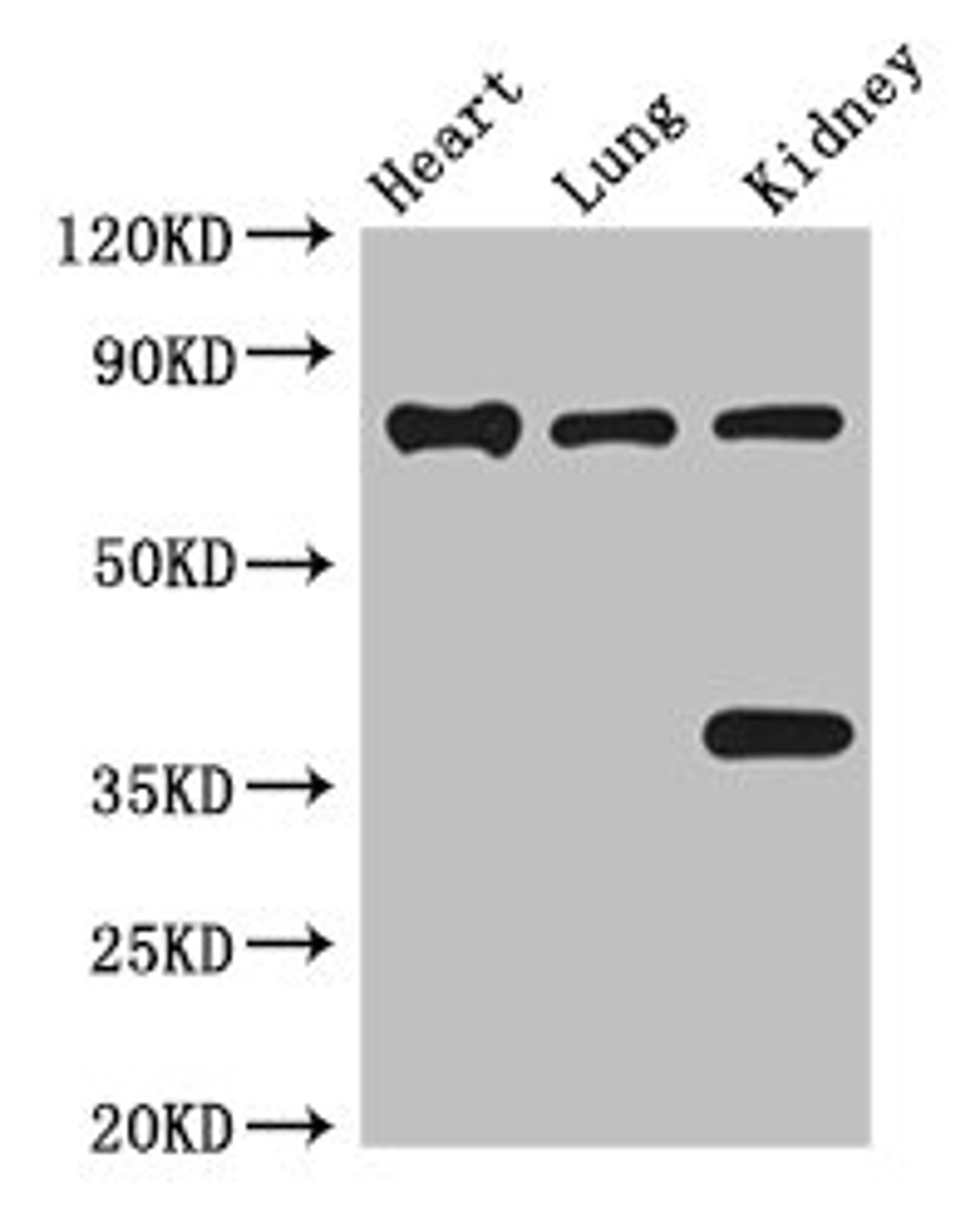 Western Blot. Positive WB detected in: Mouse heart tissue, Mouse lung tissue, Mouse kidney tissue. All lanes: BRSK1 antibody at 3.5ug/ml. Secondary. Goat polyclonal to rabbit IgG at 1/50000 dilution. Predicted band size: 86, 87, 39 kDa. Observed band size: 86, 39 kDa. 
