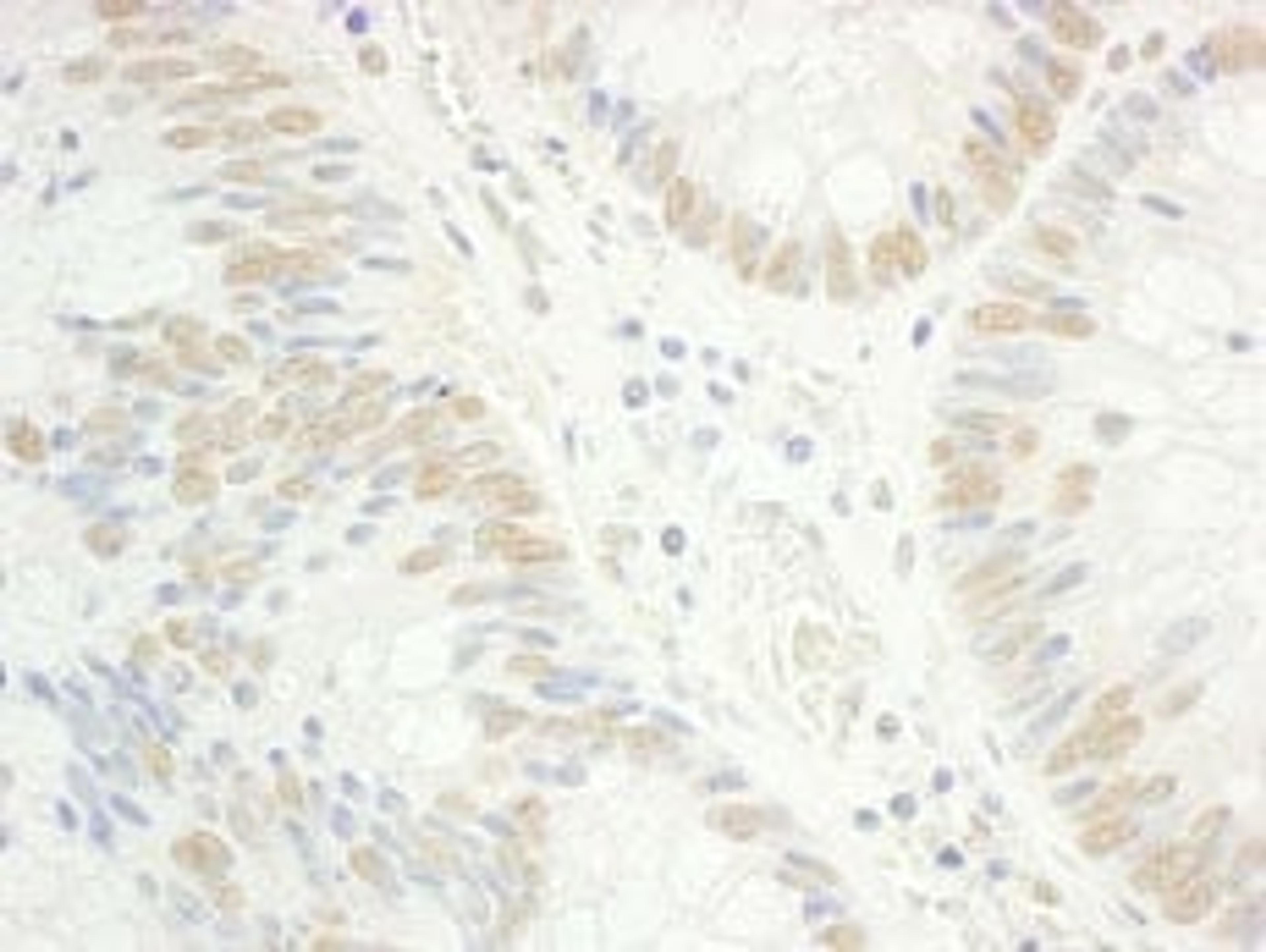 Detection of human RAP74 by immunohistochemistry.