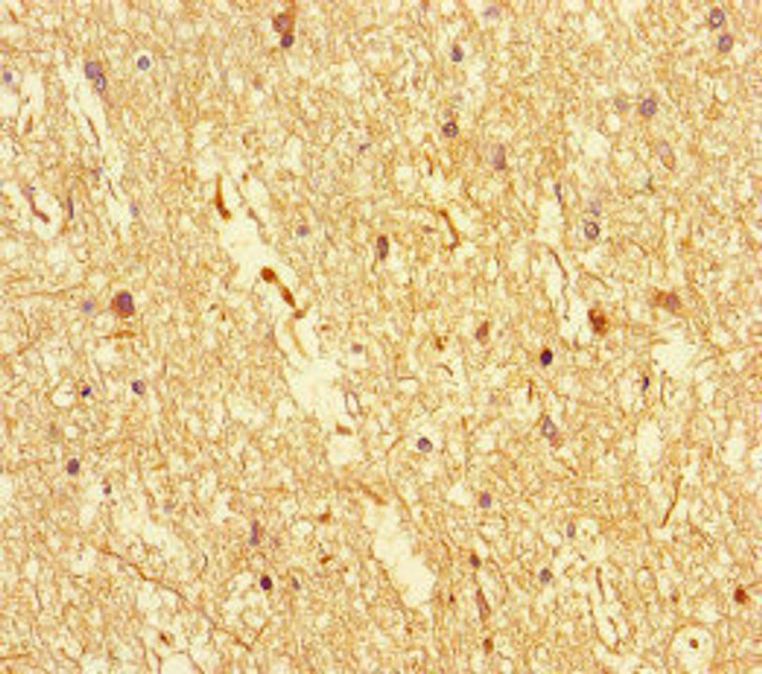 Immunohistochemistry of paraffin-embedded human brain tissue using CSB-PA818270LA01HU at dilution of 1:100