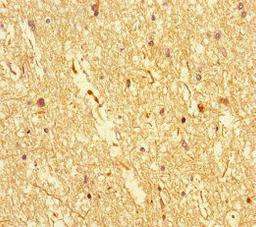 Immunohistochemistry of paraffin-embedded human brain tissue using CSB-PA818270LA01HU at dilution of 1:100