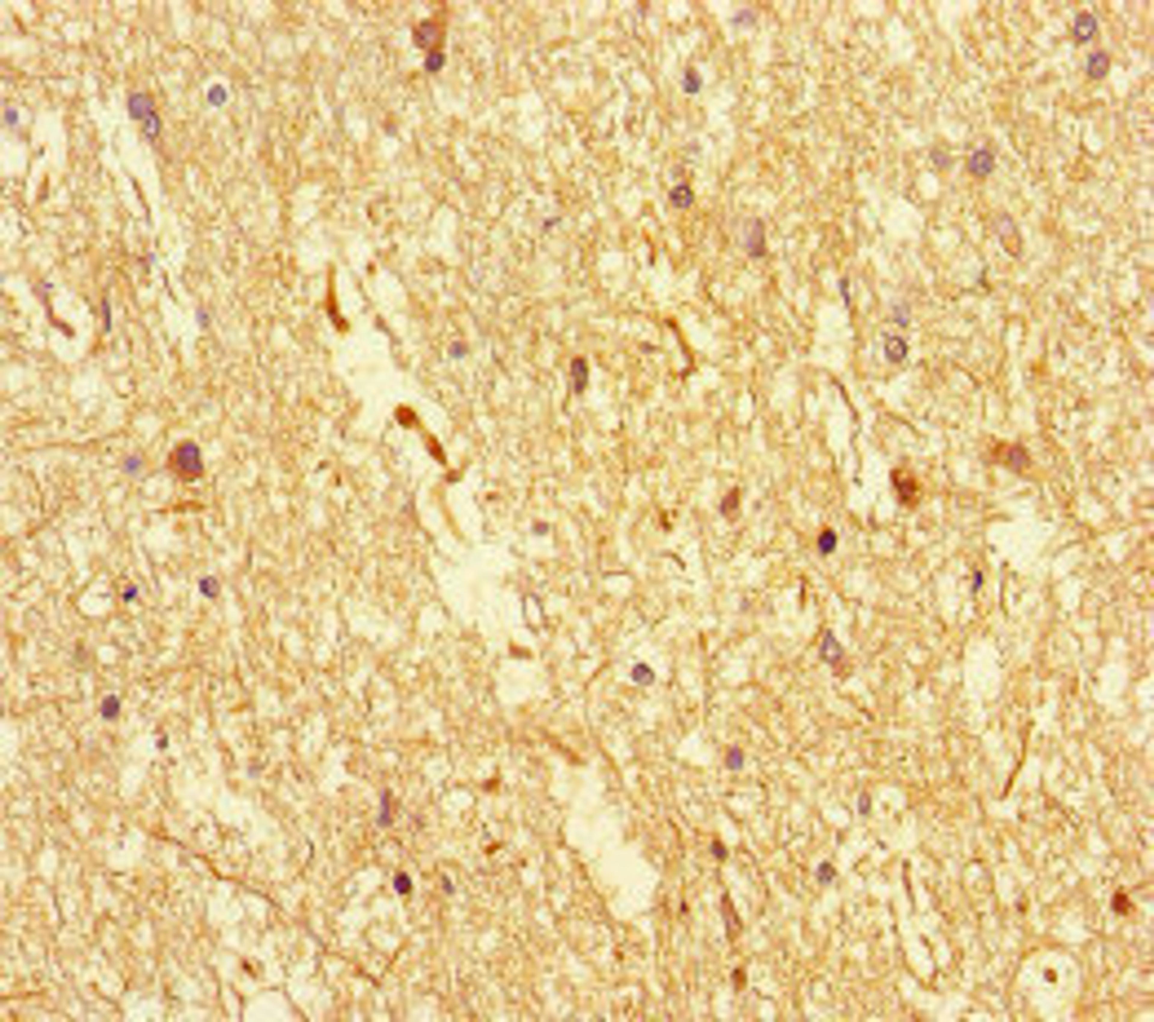 Immunohistochemistry of paraffin-embedded human brain tissue using CSB-PA818270LA01HU at dilution of 1:100