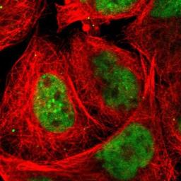 Immunocytochemistry/Immunofluorescence: FAM122B Antibody [NBP1-90508] - Staining of human cell line A-431 shows positivity in nucleus but not nucleoli.