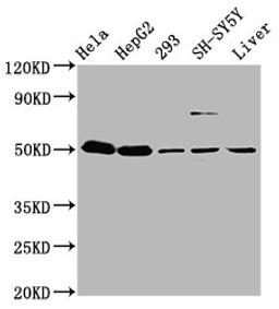 Western Blot. Positive WB detected in: Hela whole cell lysate, HepG2 whole cell lysate, 293 whole cell lysate, SH-SY5Y whole cell lysate, Mouse liver tissue. All lanes: DYM antibody at 3.7µg/ml. Secondary. Goat polyclonal to rabbit IgG at 1/50000 dilution. Predicted band size: 76, 55 kDa. Observed band size: 55 kDa