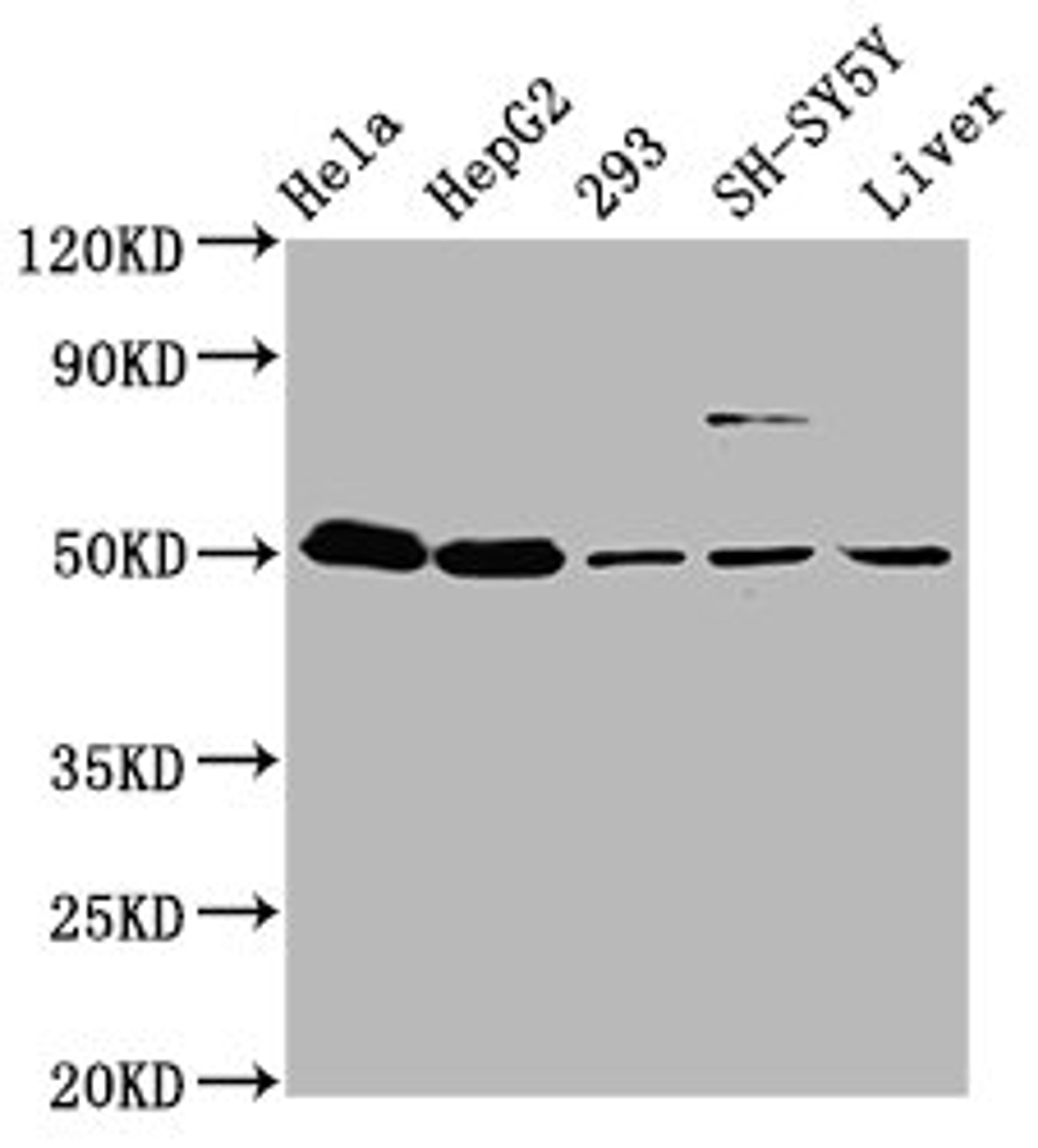 Western Blot. Positive WB detected in: Hela whole cell lysate, HepG2 whole cell lysate, 293 whole cell lysate, SH-SY5Y whole cell lysate, Mouse liver tissue. All lanes: DYM antibody at 3.7µg/ml. Secondary. Goat polyclonal to rabbit IgG at 1/50000 dilution. Predicted band size: 76, 55 kDa. Observed band size: 55 kDa