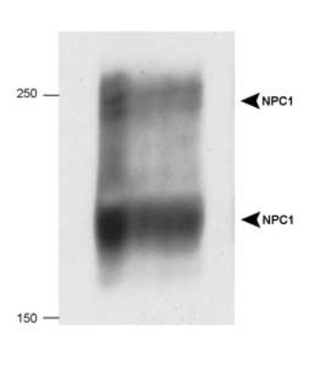 Western Blot: Niemann-Pick C1 Antibody [NB400-148] - Detection of human NPC1 in 20 ug of human fibroblast cell lysate.