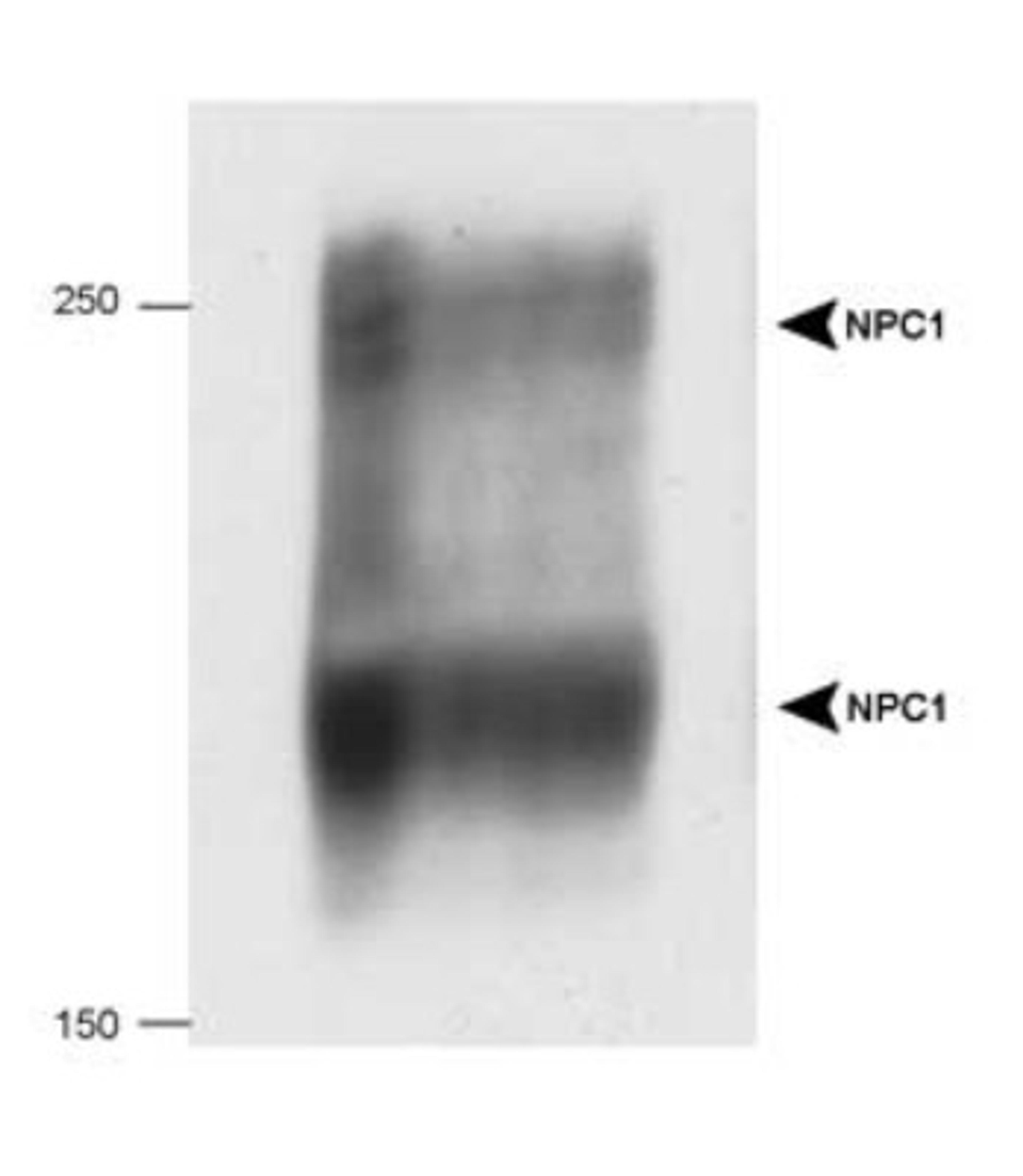 Western Blot: Niemann-Pick C1 Antibody [NB400-148] - Detection of human NPC1 in 20 ug of human fibroblast cell lysate.