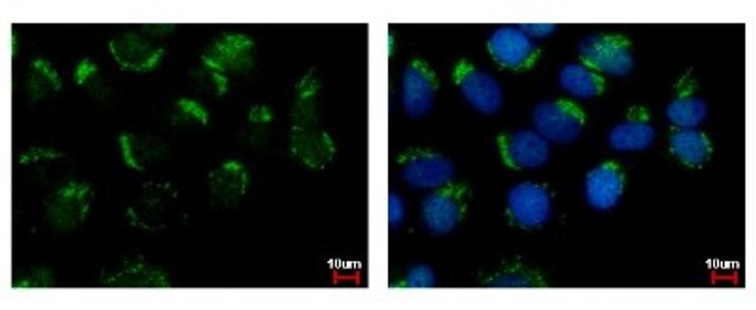 Immunocytochemistry/Immunofluorescence: WDSUB1 Antibody [NBP2-20904] - Sample: MCF-7 cells were fixed in 4% paraformaldehyde at RT for 15 min. Green: WDSUB1 protein stained by WDSUB1 antibody diluted at 1:500. Blue: Hoechst 33342 staining.