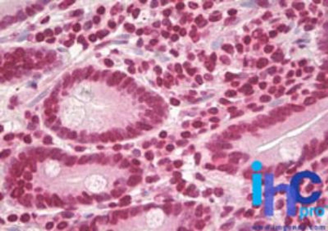 Immunohistochemistry-Paraffin: Cyclin D1 Antibody [NBP2-24695] - Formalin-fixed, paraffin-embedded human small intestine stained with Cyclin D1 antibody at 10 ug/ml.