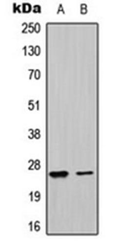 Western blot analysis of HepG2 (Lane 1), K562 (Lane 2) whole cell lysates using UBTD1 antibody