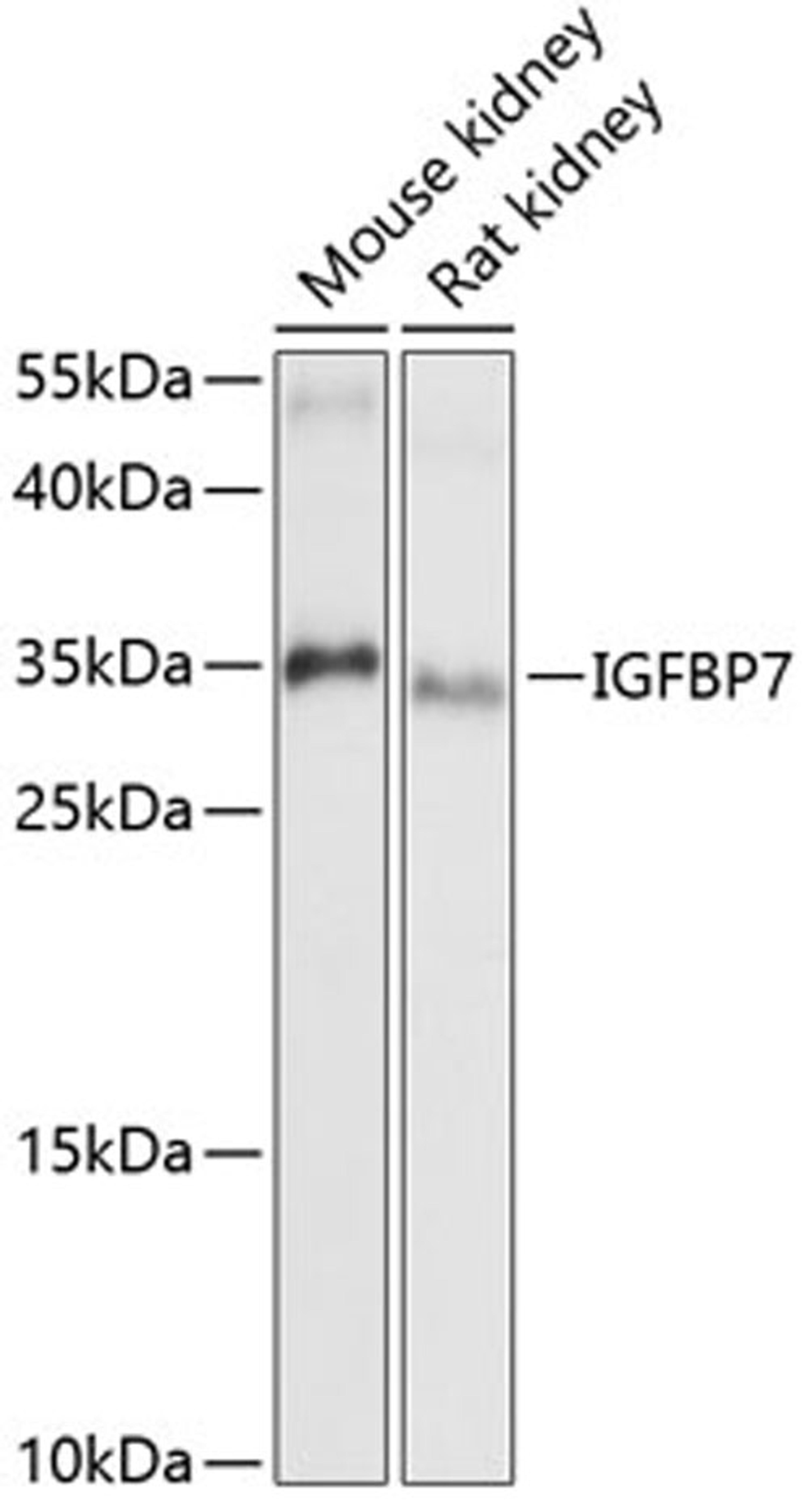 Western blot - IGFBP7 antibody (A13023)