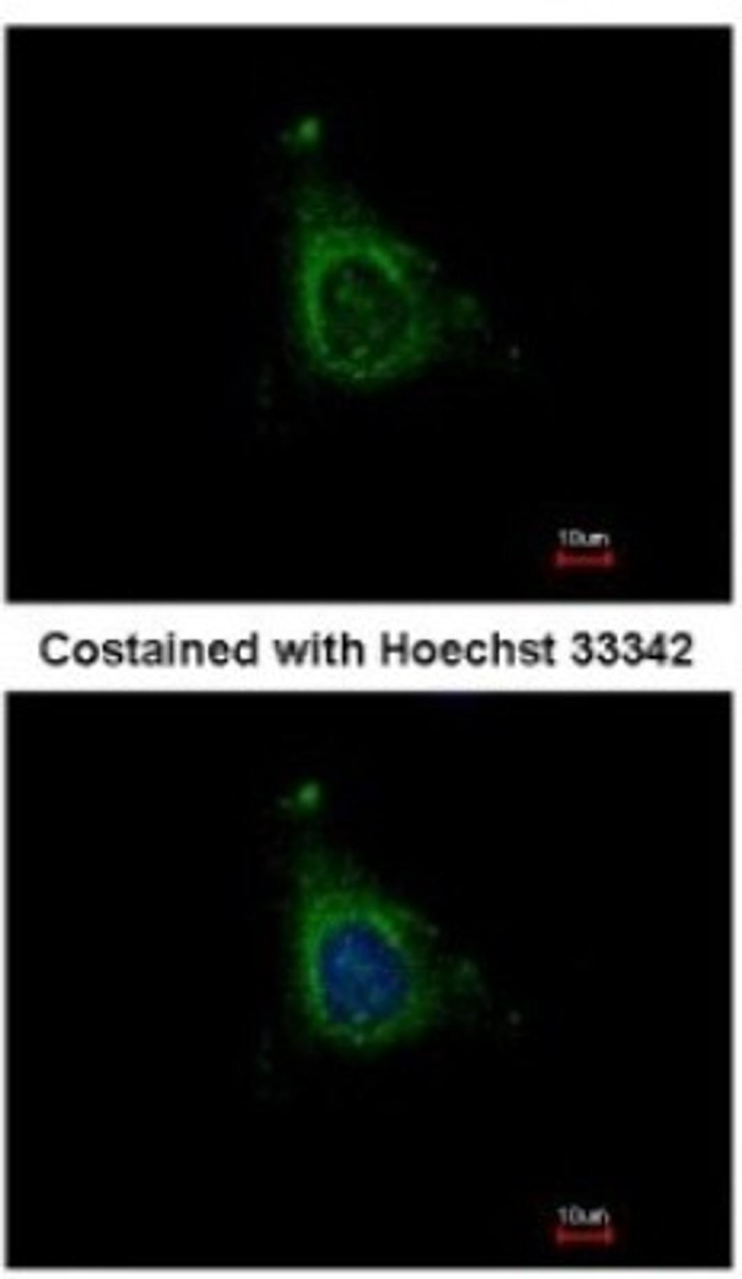 Immunocytochemistry/Immunofluorescence: AKAP10 Antibody [NBP1-31483] - Analysis of methanol-fixed HeLa, using antibody at 1:500 dilution.