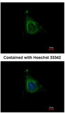 Immunocytochemistry/Immunofluorescence: AKAP10 Antibody [NBP1-31483] - Analysis of methanol-fixed HeLa, using antibody at 1:500 dilution.