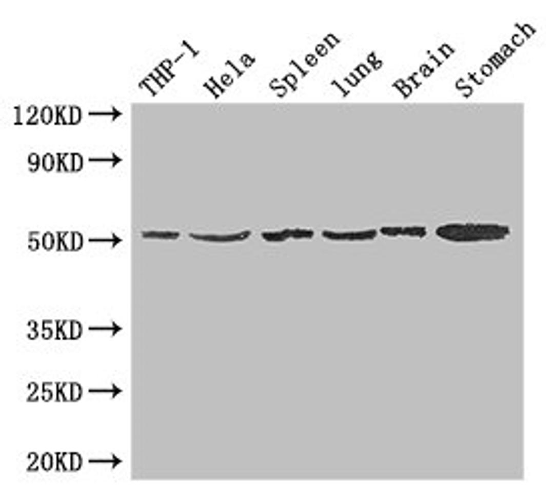 Western Blot. Positive WB detected in: THP-1 whole cell lysate, Hela whole cell lysate, Mouse spleen tissue, Mouse lung tissue, Mouse brain tissue, Mouse stomach tissue. All lanes: MSR1 antibody at 1.5ug/ml. Secondary. Goat polyclonal to rabbit IgG at 1/50000 dilution. Predicted band size: 50, 40, 43 kDa. Observed band size: 50 kDa.