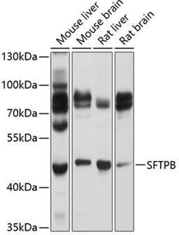 Western blot - SFTPB Antibody (A1748)