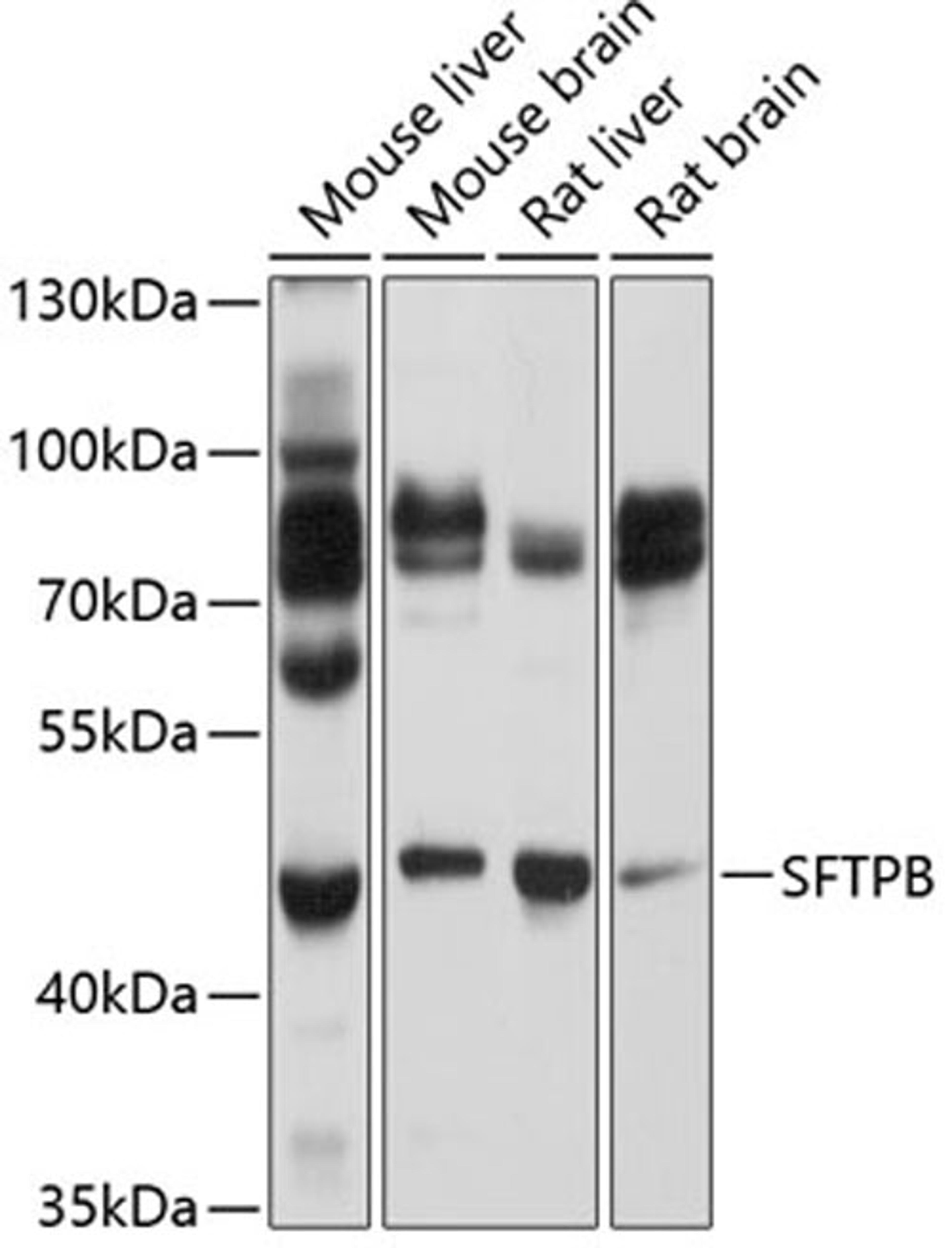 Western blot - SFTPB Antibody (A1748)