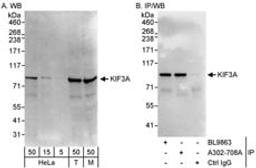 Detection of human and mouse KIF3A by western blot (h&m) and immunoprecipitation (h).